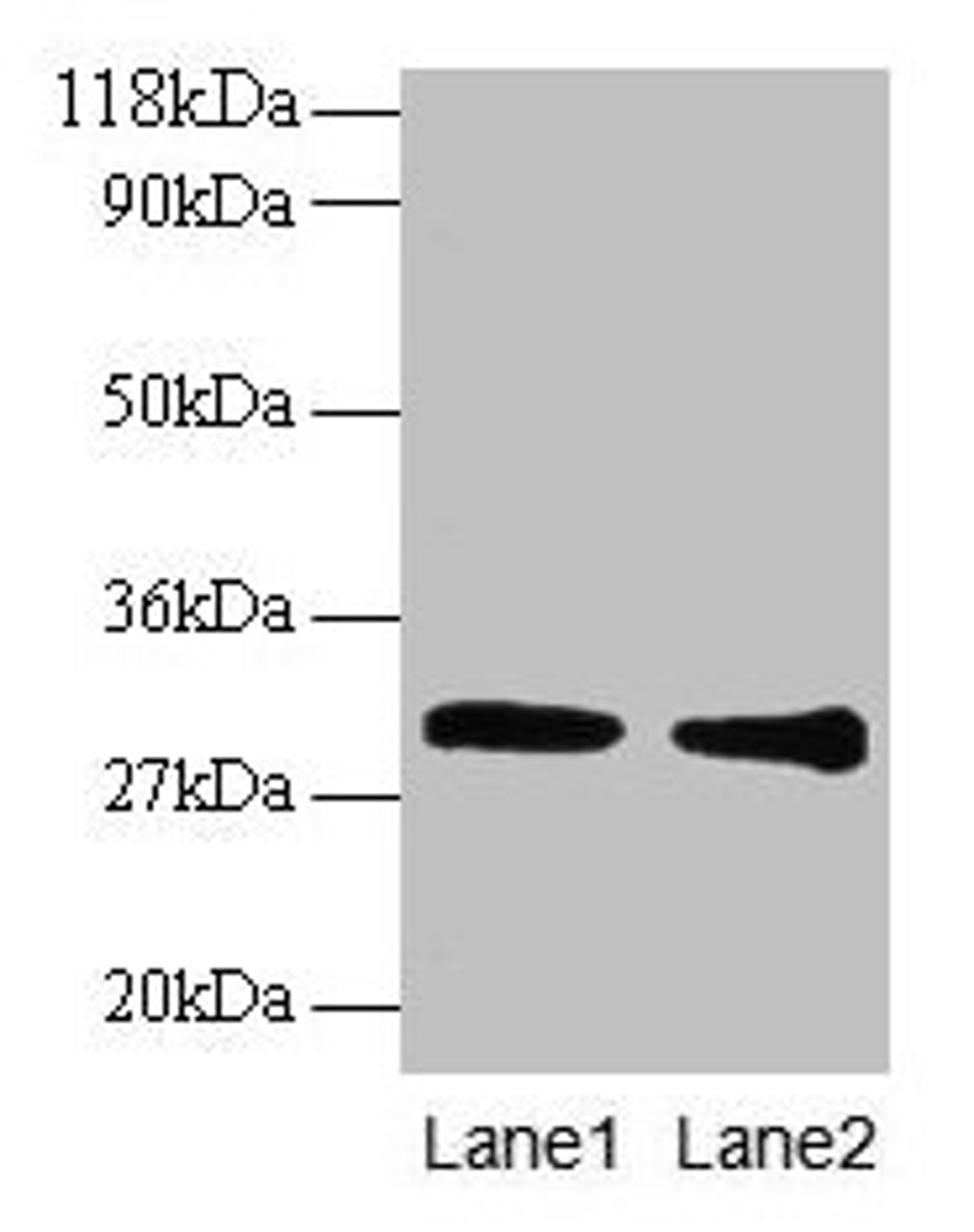 Western blot. All lanes: GSTP1 antibody at 2µg/ml. Lane 1: EC109 whole cell lysate. Lane 2: 293T whole cell lysate. Secondary. Goat polyclonal to rabbit IgG at 1/15000 dilution. Predicted band size: 24 kDa. Observed band size: 30 kDa