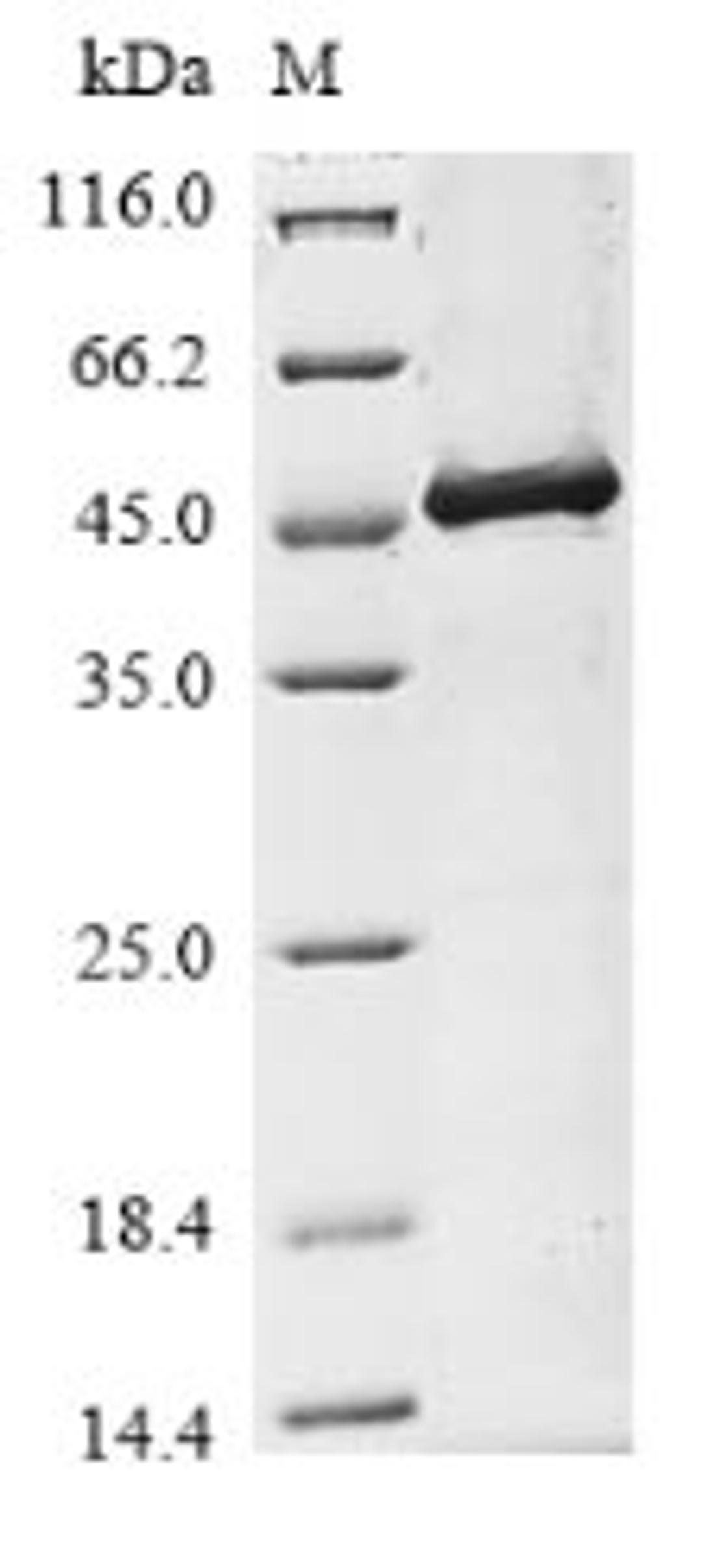 (Tris-Glycine gel) Discontinuous SDS-PAGE (reduced) with 5% enrichment gel and 15% separation gel.