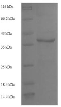 (Tris-Glycine gel) Discontinuous SDS-PAGE (reduced) with 5% enrichment gel and 15% separation gel.
