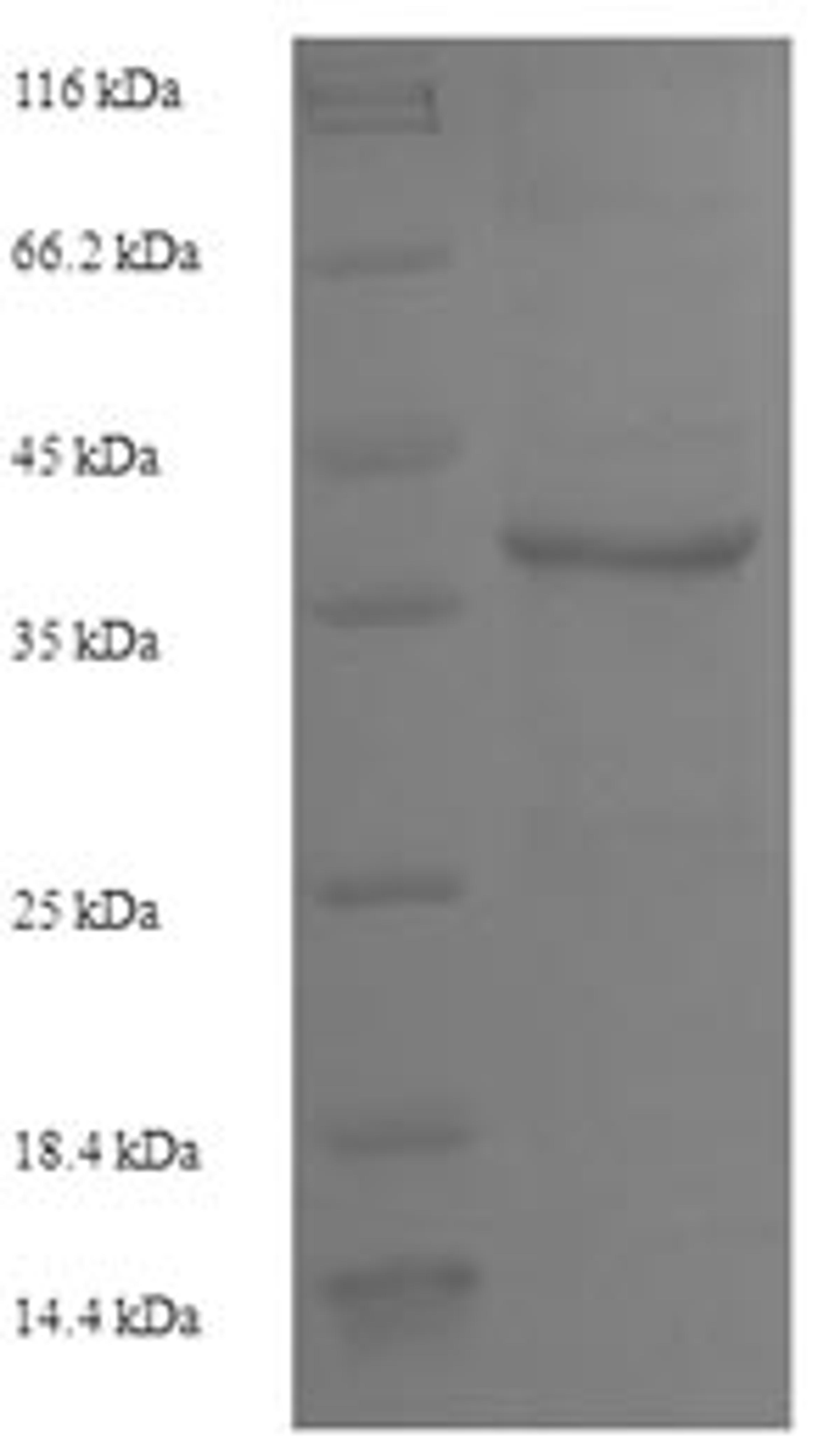 (Tris-Glycine gel) Discontinuous SDS-PAGE (reduced) with 5% enrichment gel and 15% separation gel.