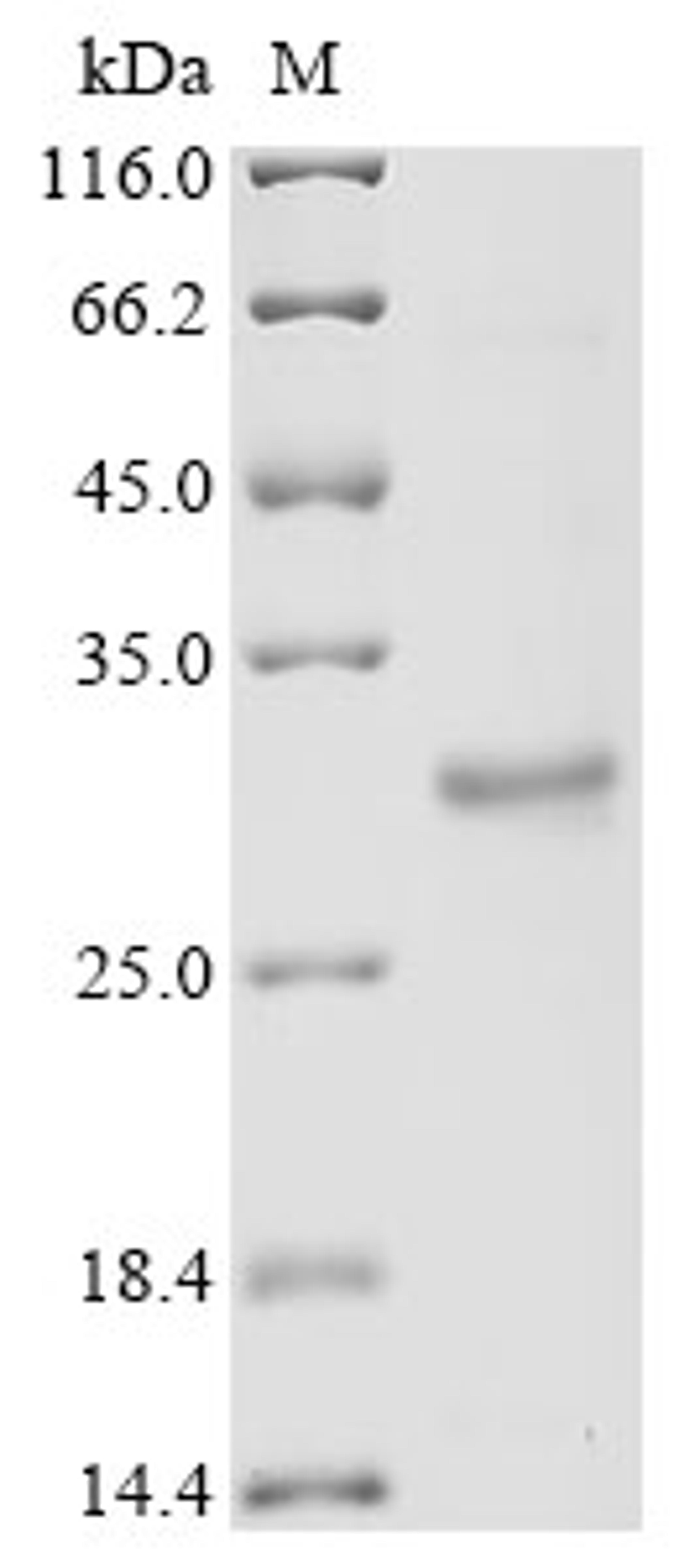 (Tris-Glycine gel) Discontinuous SDS-PAGE (reduced) with 5% enrichment gel and 15% separation gel.