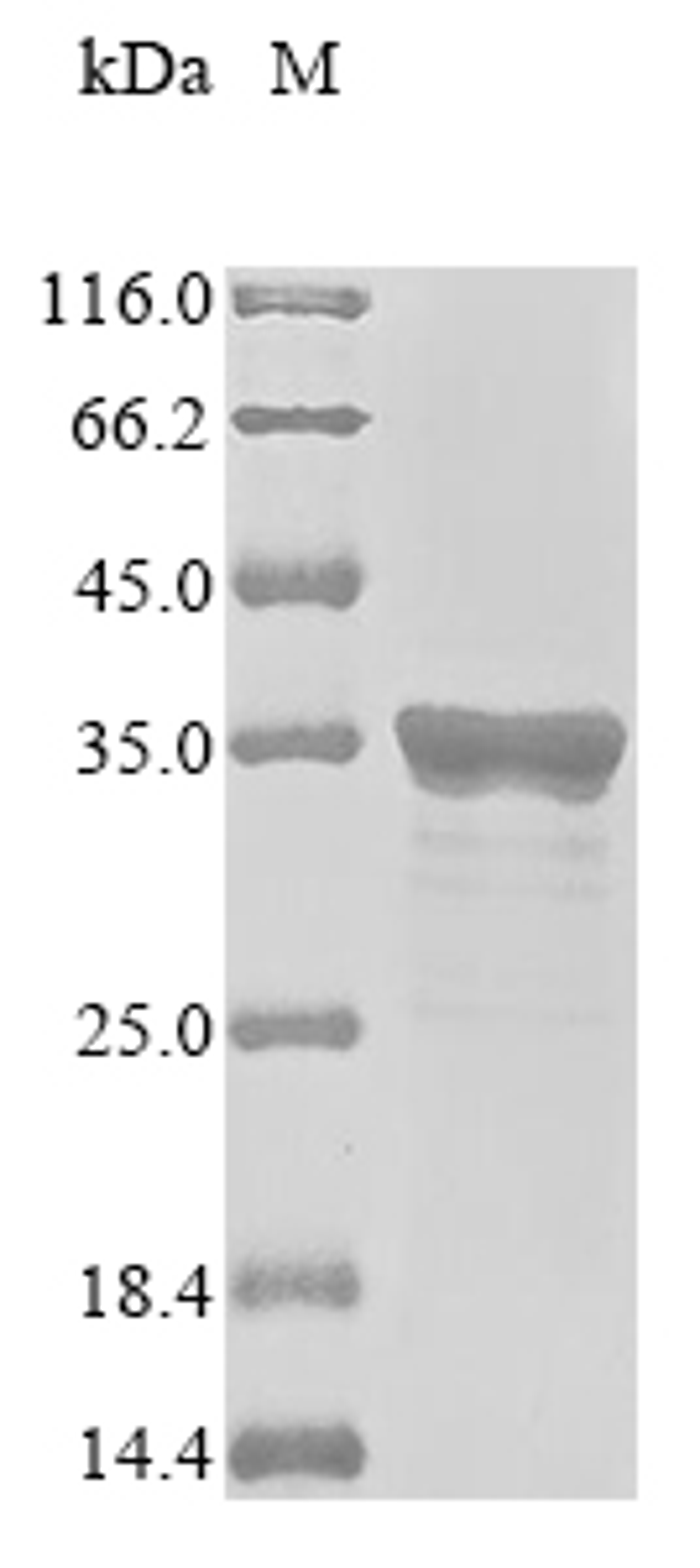 (Tris-Glycine gel) Discontinuous SDS-PAGE (reduced) with 5% enrichment gel and 15% separation gel.