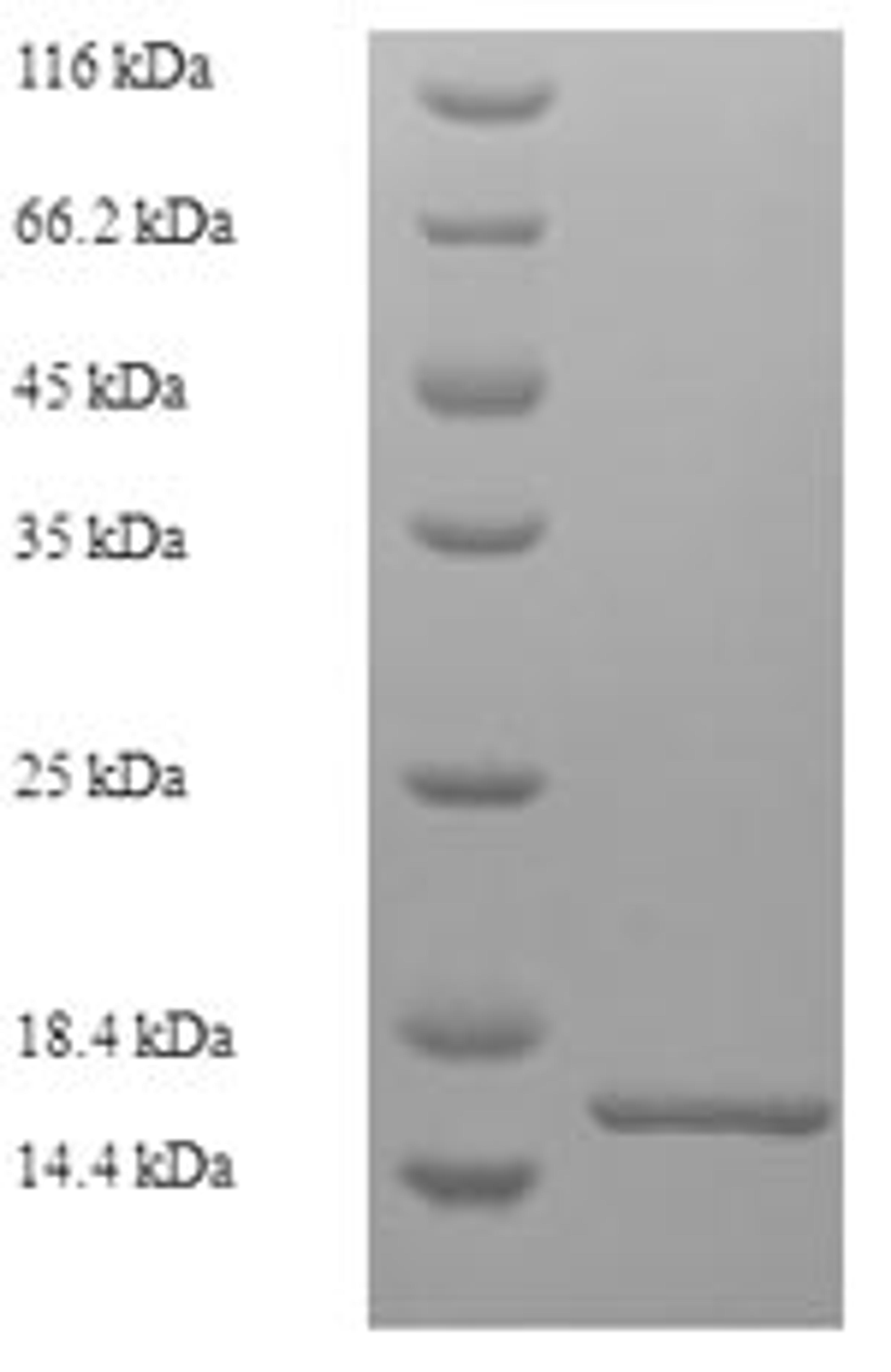 (Tris-Glycine gel) Discontinuous SDS-PAGE (reduced) with 5% enrichment gel and 15% separation gel.