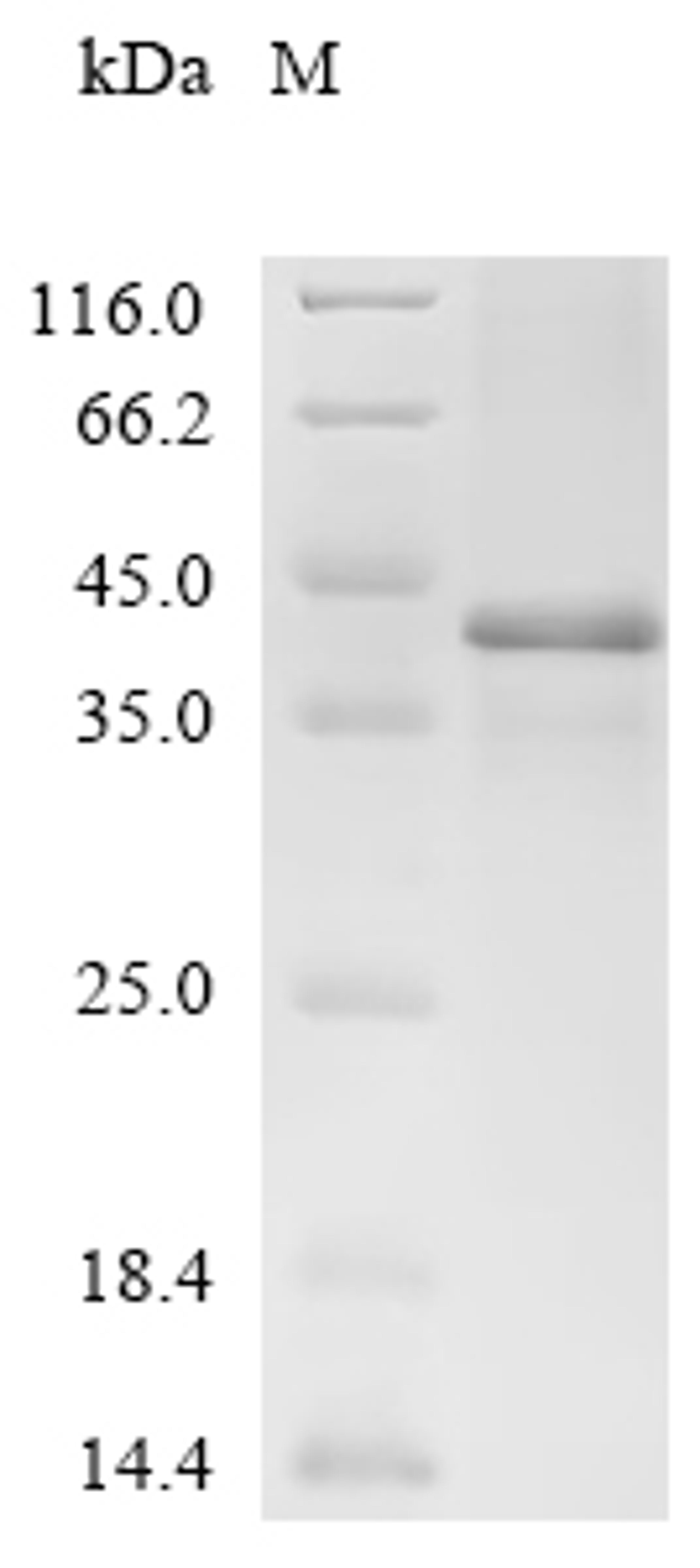 (Tris-Glycine gel) Discontinuous SDS-PAGE (reduced) with 5% enrichment gel and 15% separation gel.