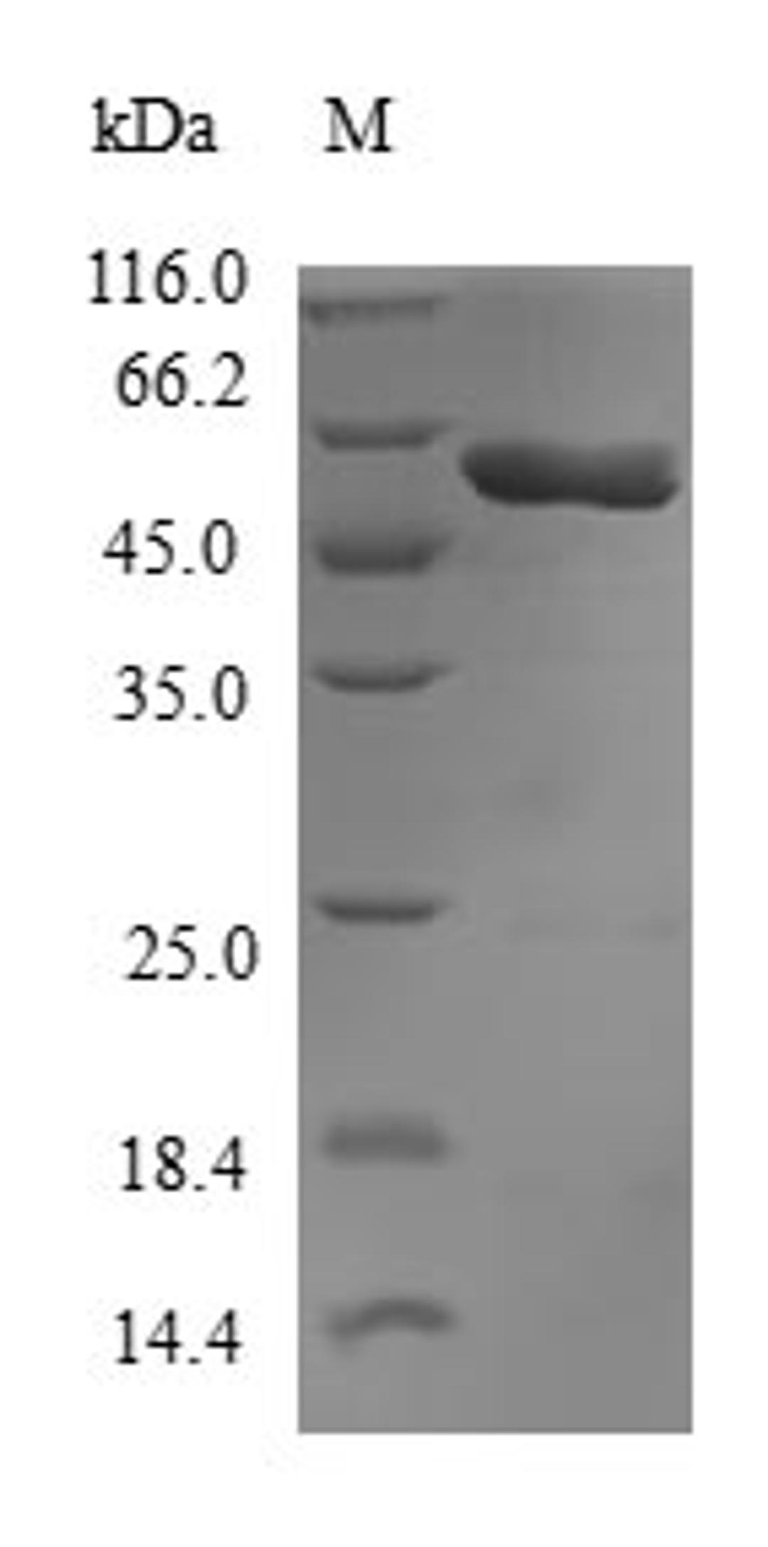 (Tris-Glycine gel) Discontinuous SDS-PAGE (reduced) with 5% enrichment gel and 15% separation gel.