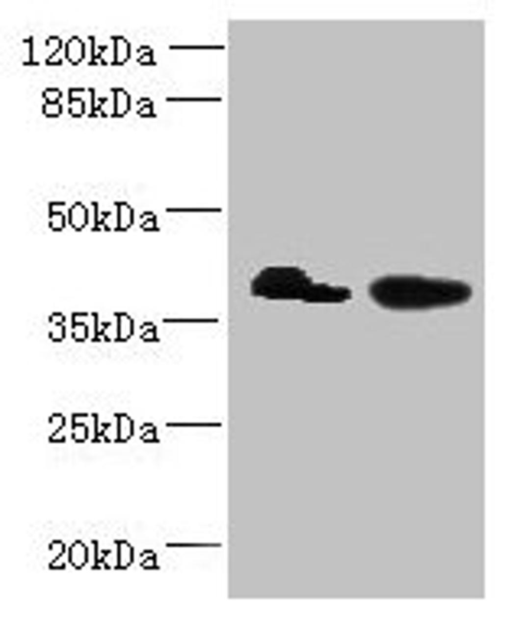 Western blot. All lanes: L3HYPDH antibody at 8µg/ml. Lane 1: HepG2 whole cell lysate. Lane 2: A549 whole cell lysate. Secondary. Goat polyclonal to rabbit IgG at 1/10000 dilution. Predicted band size: 39 kDa. Observed band size: 39 kDa