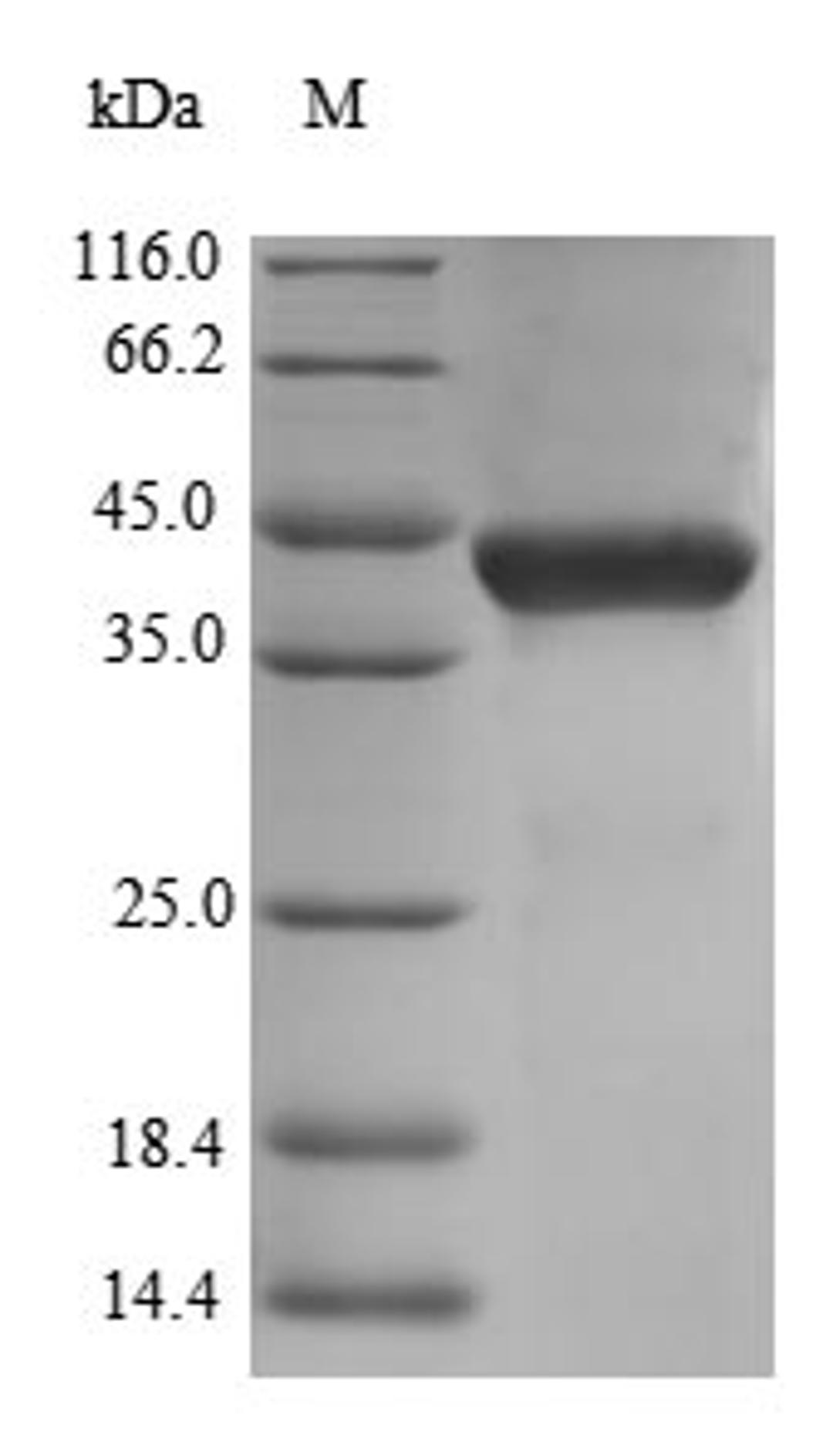 (Tris-Glycine gel) Discontinuous SDS-PAGE (reduced) with 5% enrichment gel and 15% separation gel.