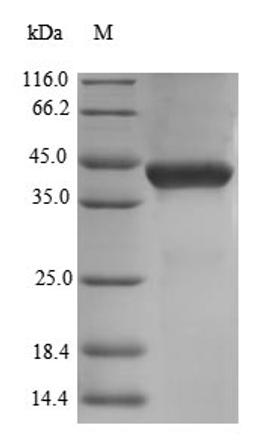 (Tris-Glycine gel) Discontinuous SDS-PAGE (reduced) with 5% enrichment gel and 15% separation gel.