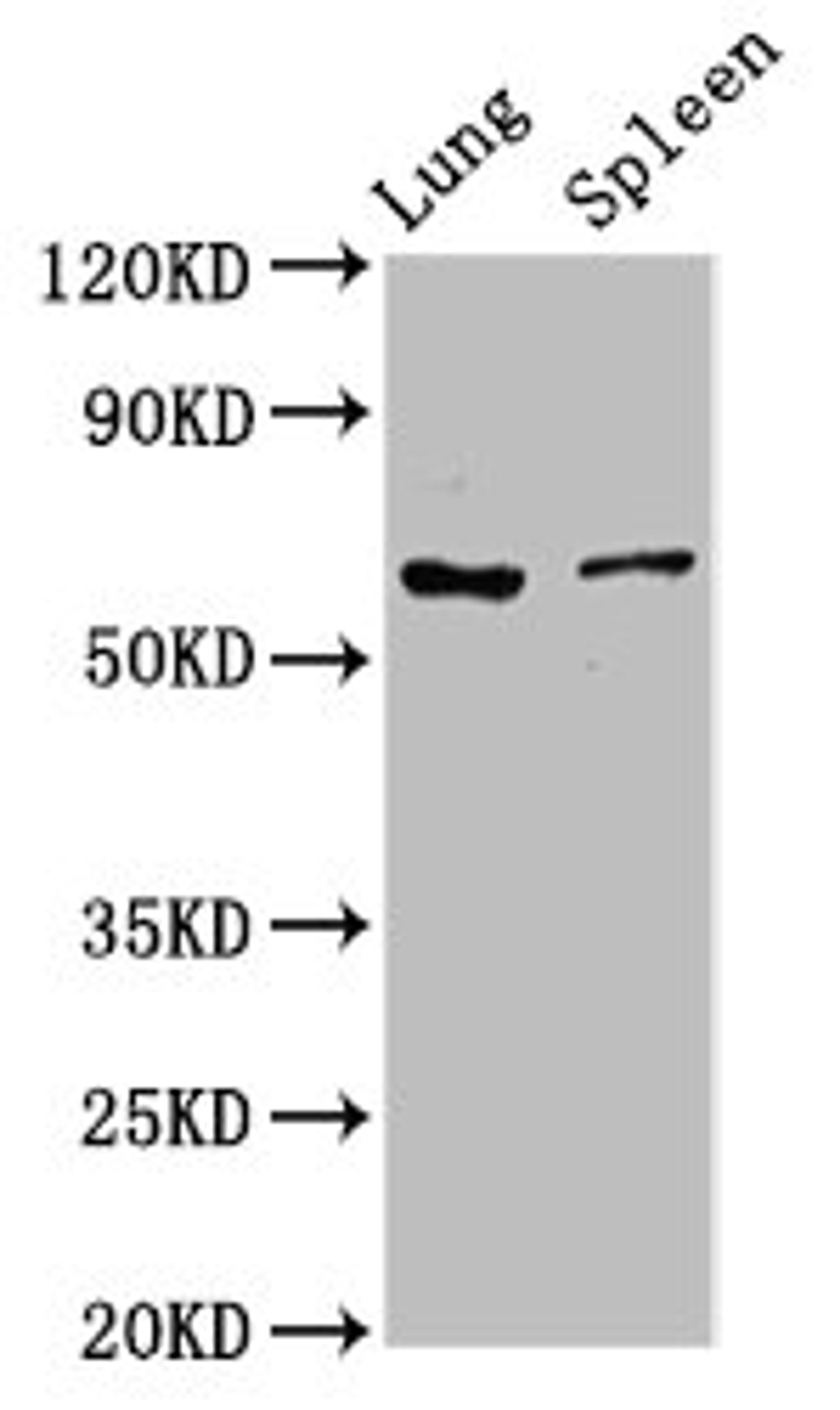 Western Blot. Positive WB detected in: Rat lung tissue, Rat spleen tissue. All lanes: RIPK2 antibody at 2.7µg/ml. Secondary. Goat polyclonal to rabbit IgG at 1/50000 dilution. Predicted band size: 62, 46 kDa. Observed band size: 62 kDa
