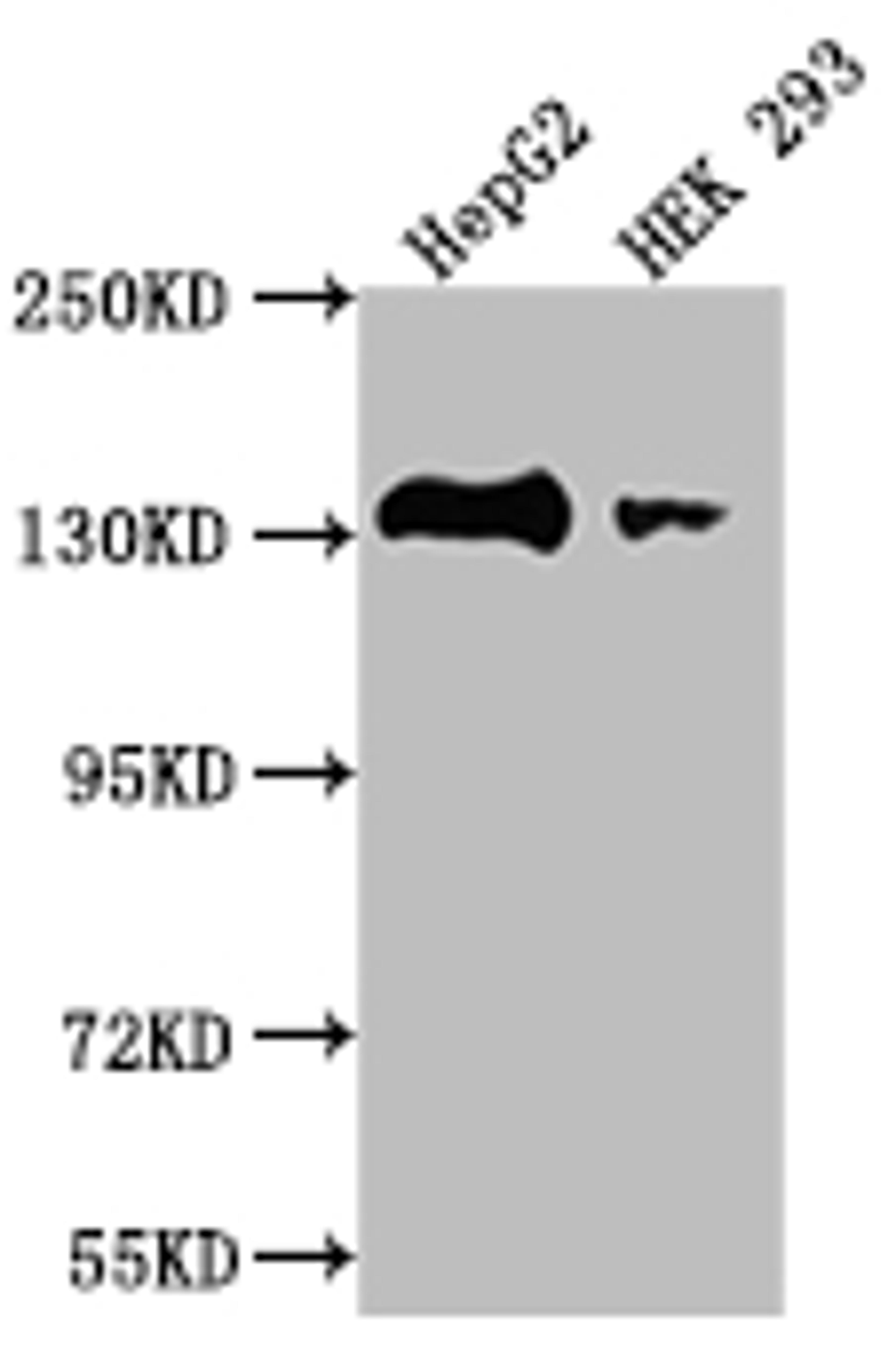 Western Blot. Positive WB detected in: HepG2 whole cell lysate, HEK293 whole cell lysate. All lanes: MYLK antibody at 1:2000. Secondary. Goat polyclonal to rabbit IgG at 1/50000 dilution. Predicted band size: 211, 204, 206, 198, 203, 111, 17, 81 kDa. Observed band size: 130-250 kDa.