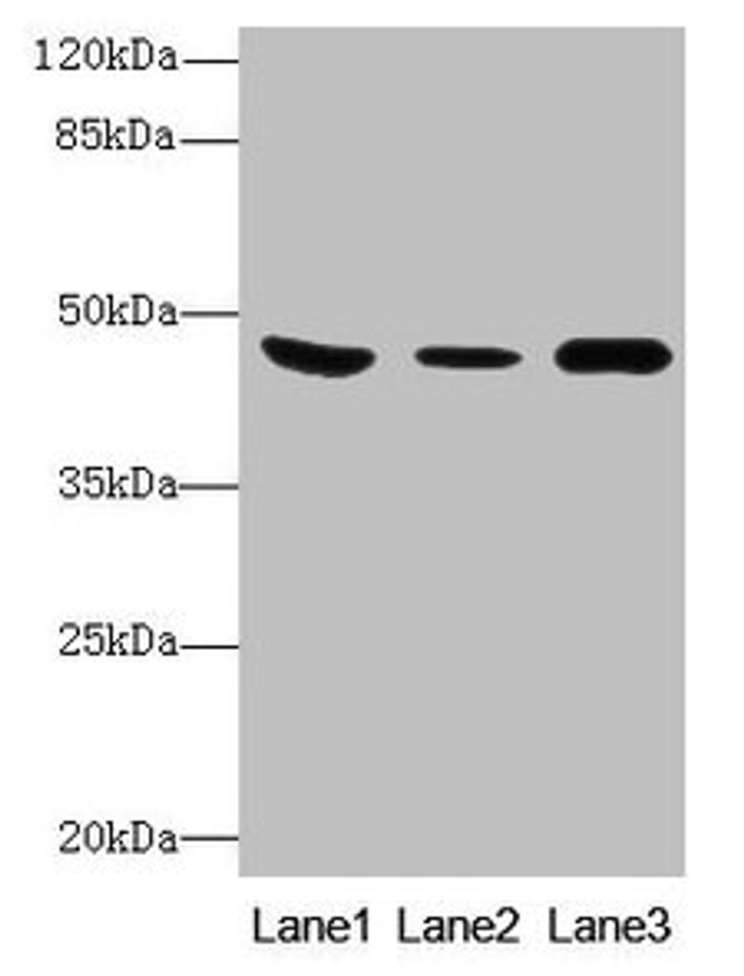 Western Blot. All lanes: B4GALT5 antibody at 8µg/ml. Lane 1: Mouse heart tissue. Lane 2: Mouse liver tissue. Lane 3: Mouse brain tissue. Secondary. Goat polyclonal to rabbit IgG at 1/10000 dilution. Predicted band size: 46 kDa. Observed band size: 46 kDa