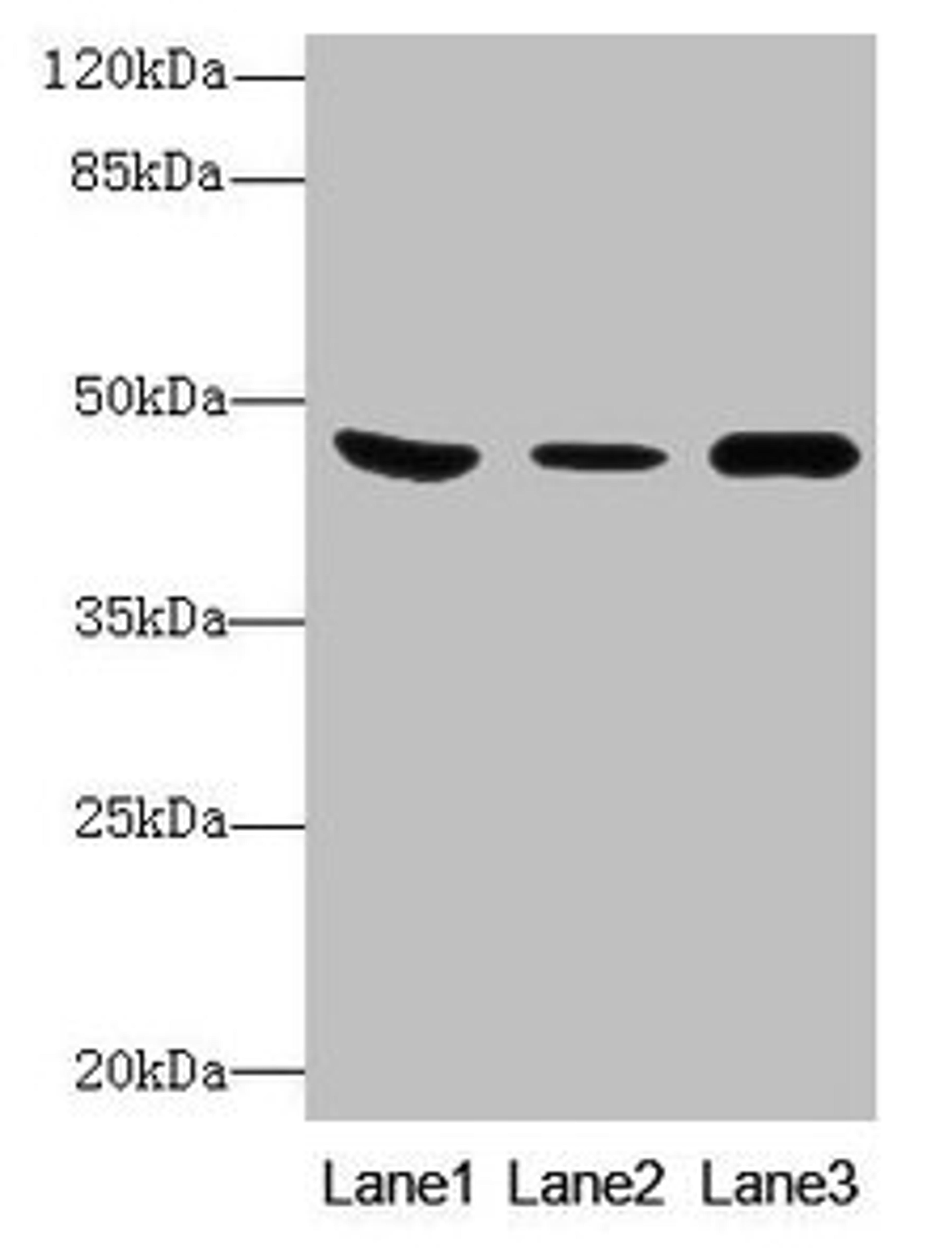 Western Blot. All lanes: B4GALT5 antibody at 8µg/ml. Lane 1: Mouse heart tissue. Lane 2: Mouse liver tissue. Lane 3: Mouse brain tissue. Secondary. Goat polyclonal to rabbit IgG at 1/10000 dilution. Predicted band size: 46 kDa. Observed band size: 46 kDa
