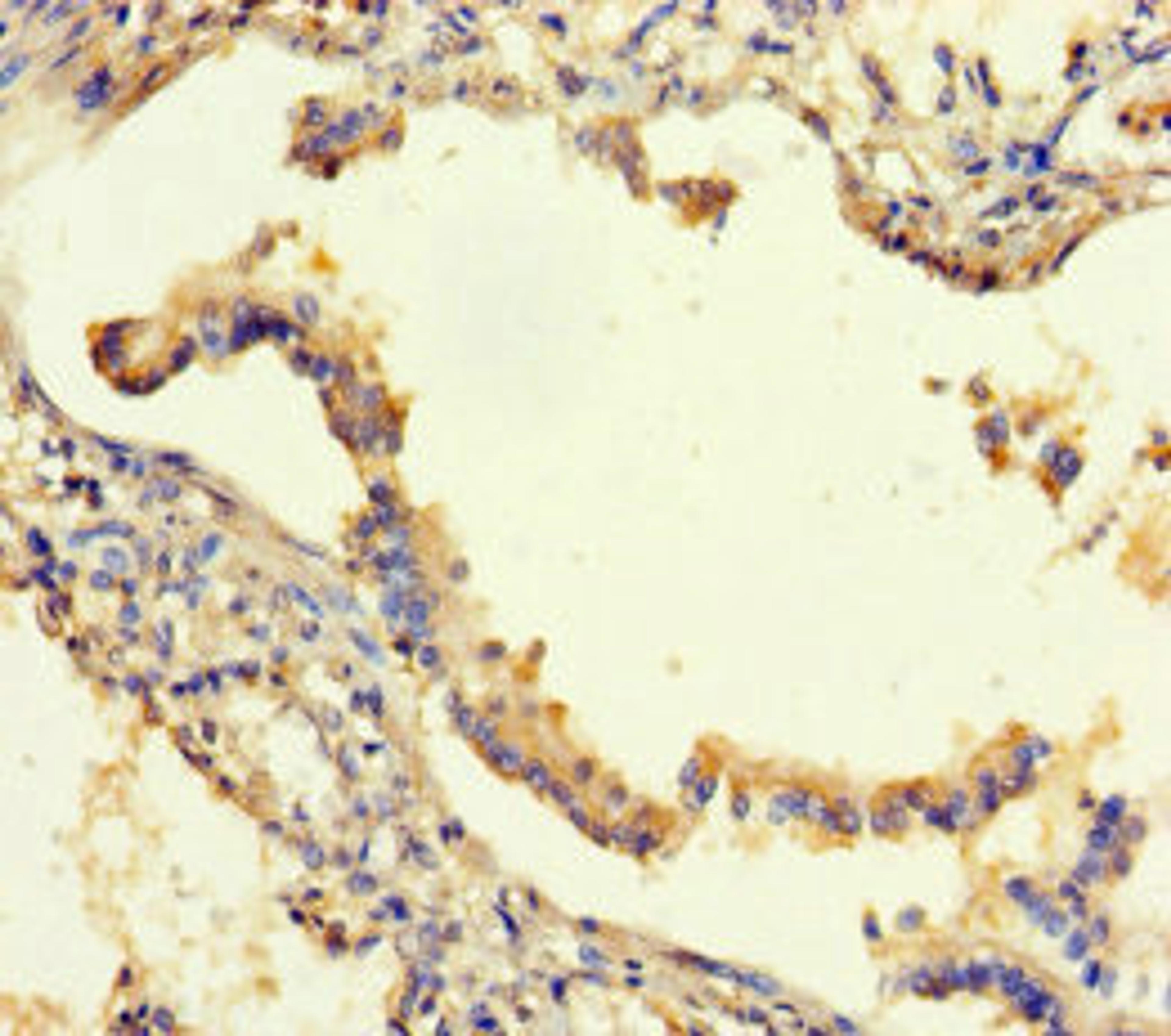 Immunohistochemistry of paraffin-embedded human lung tissue using CSB-PA613413LA01HU at dilution of 1:100