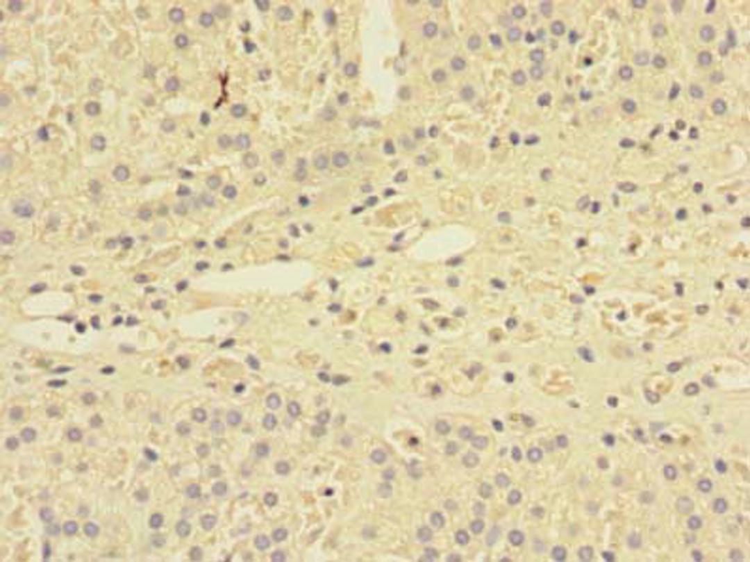 Immunohistochemistry of paraffin-embedded human adrenal gland tissue using CSB-PA818677LA01HU at dilution of 1:100