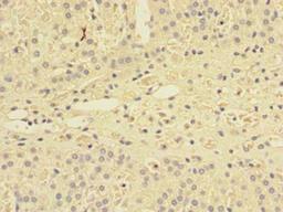 Immunohistochemistry of paraffin-embedded human adrenal gland tissue using CSB-PA818677LA01HU at dilution of 1:100