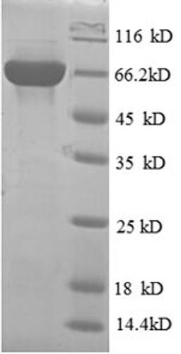 (Tris-Glycine gel) Discontinuous SDS-PAGE (reduced) with 5% enrichment gel and 15% separation gel.