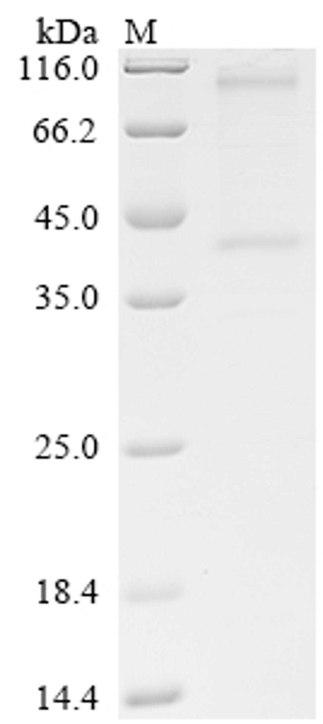 (Tris-Glycine gel) Discontinuous SDS-PAGE (reduced) with 5% enrichment gel and 15% separation gel.
