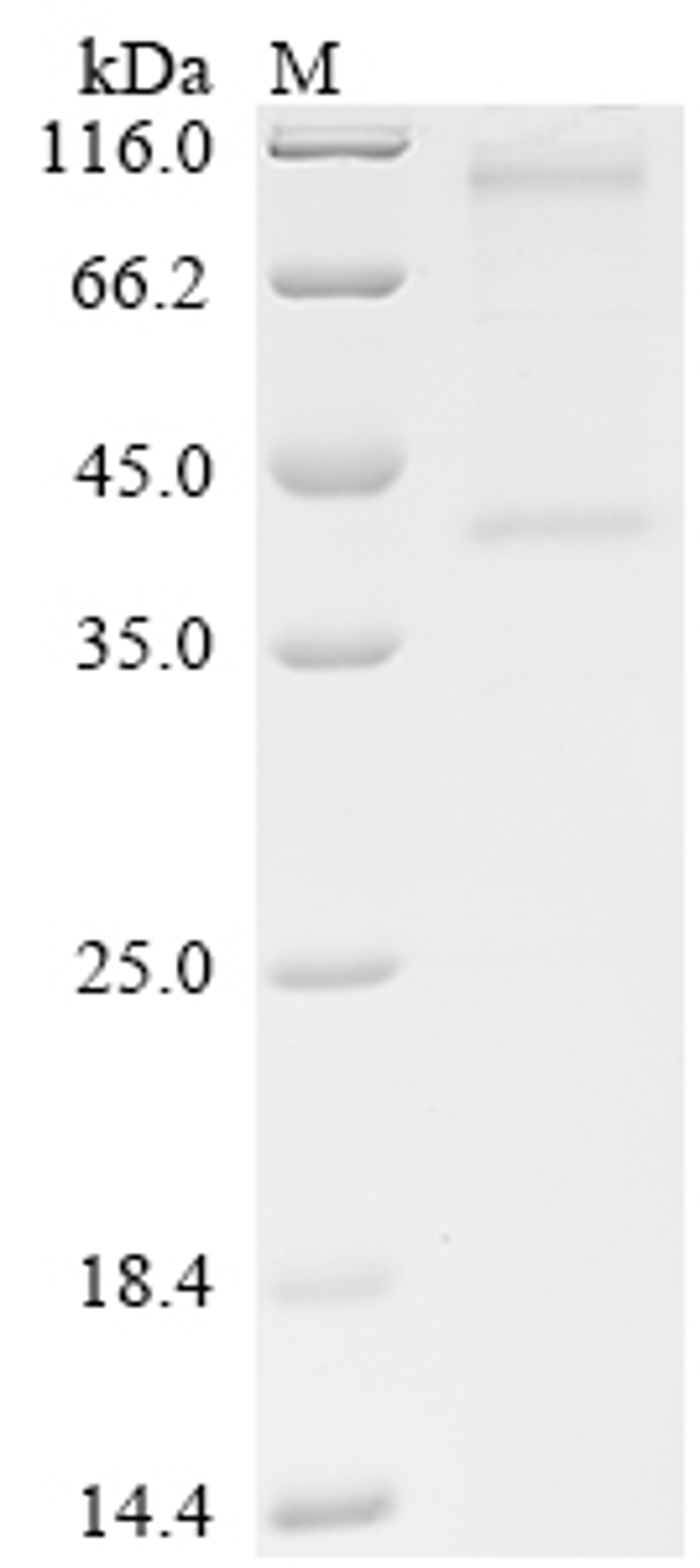 (Tris-Glycine gel) Discontinuous SDS-PAGE (reduced) with 5% enrichment gel and 15% separation gel.