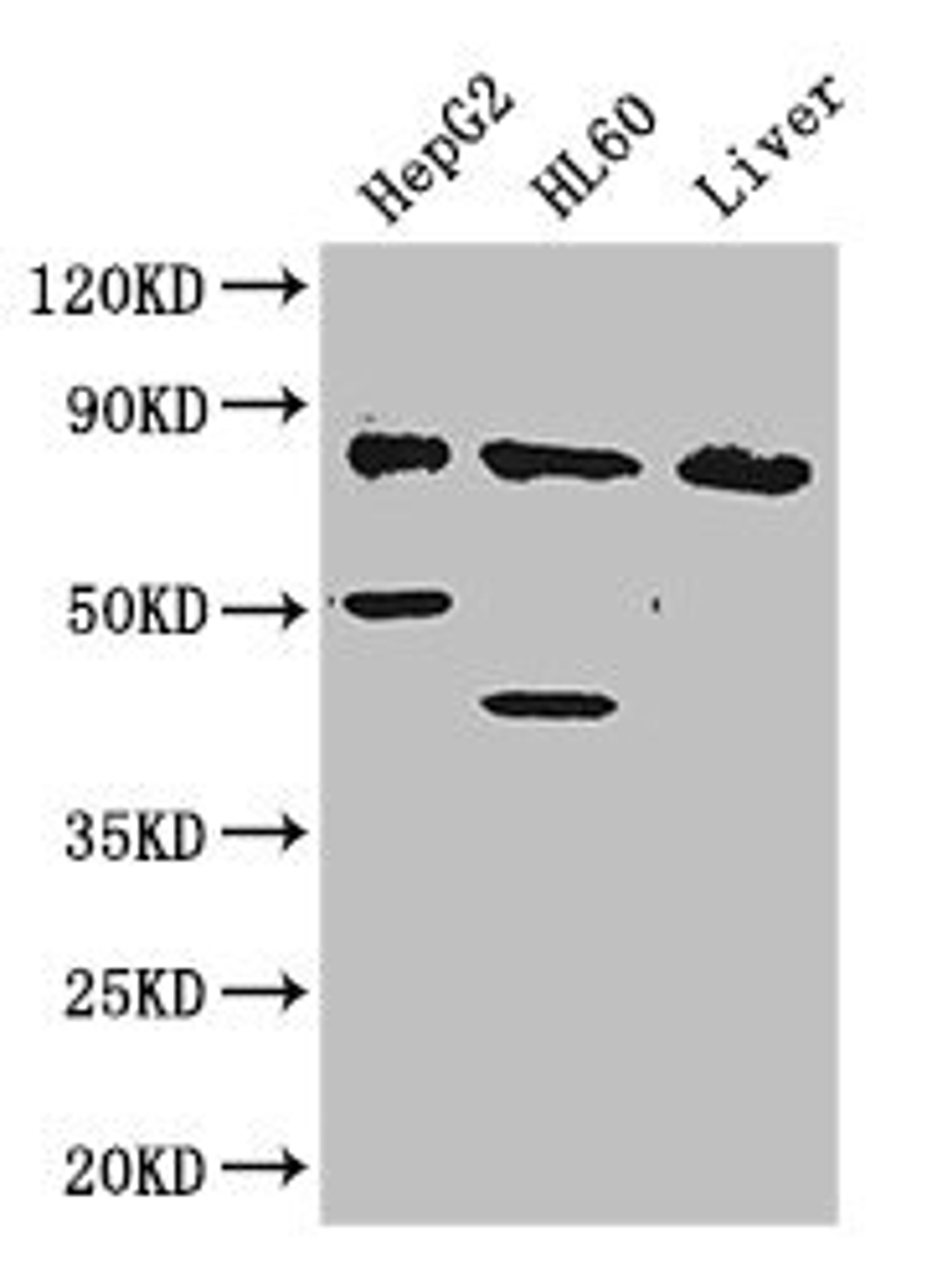 Western Blot. Positive WB detected in: HepG2 whole cell lysate, HL60 whole cell lysate, Mouse liver tissue. All lanes: PFKL antibody at 2.8ug/ml. Secondary. Goat polyclonal to rabbit IgG at 1/50000 dilution. Predicted band size: 86, 91 kDa. Observed band size: 86, 50, 40 kDa. 