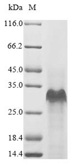 (Tris-Glycine gel) Discontinuous SDS-PAGE (reduced) with 5% enrichment gel and 15% separation gel.