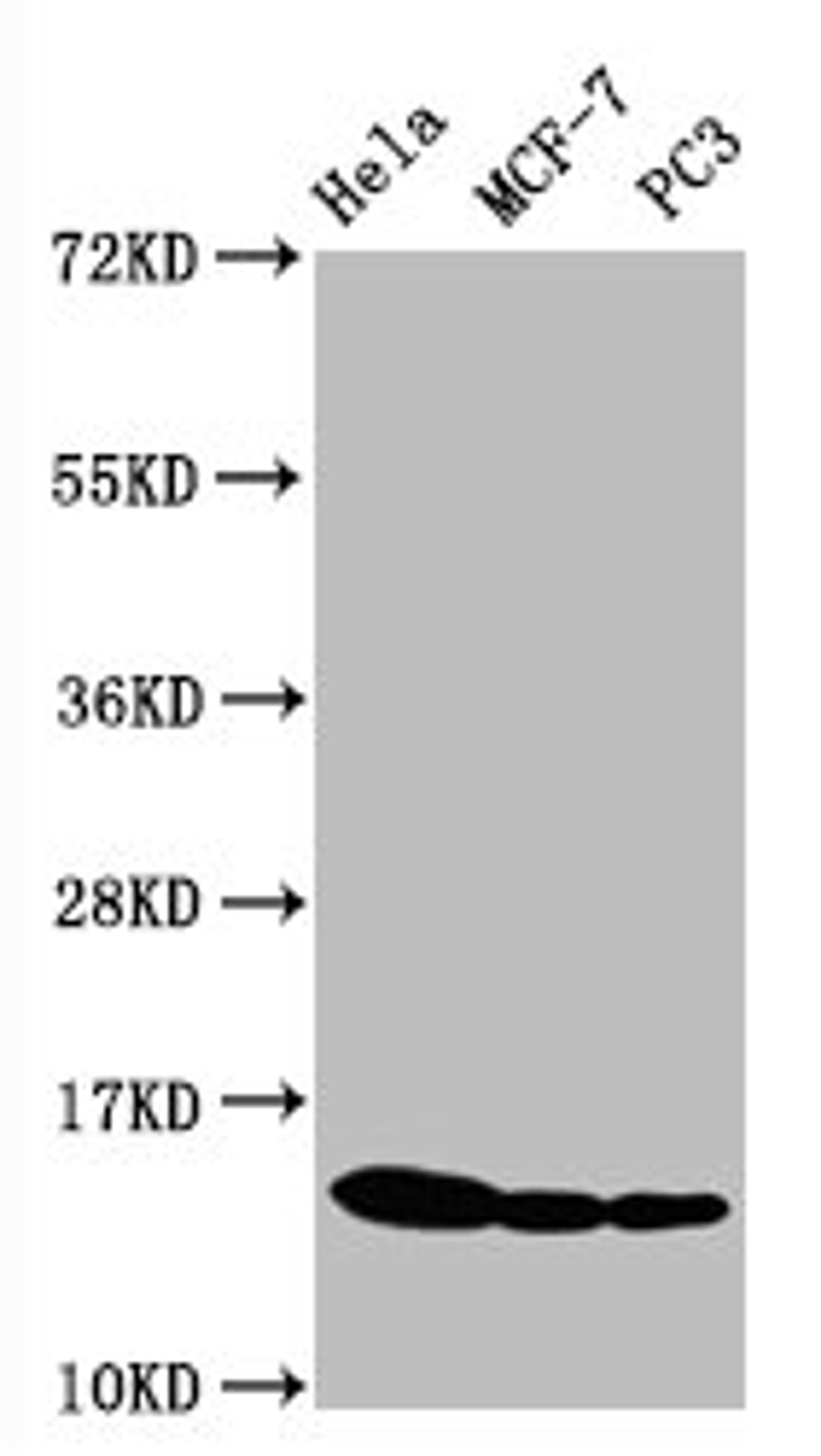 Western Blot. Positive WB detected in Hela whole cell lysate锛孧CF-7 whole cell lysate锛孭C3 whole cell lysate. All lanes Phospho-Histone H3.1(S10)antibody at 0.5μg/ml. Secondary. Goat polyclonal to rabbit IgG at 1/50000 dilution. Predicted band size: 15 KDa. Observed band size: 15 KDa.