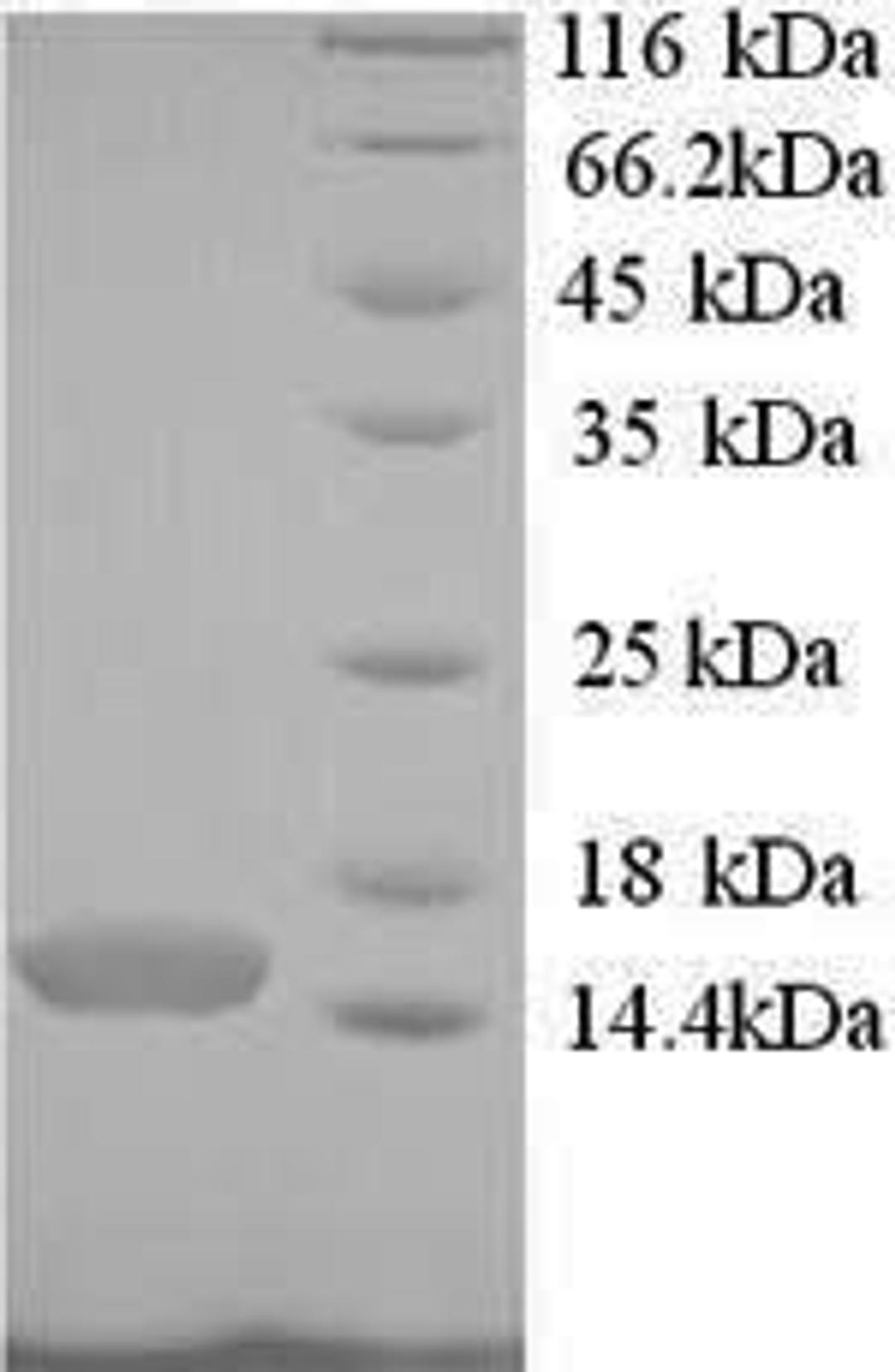 (Tris-Glycine gel) Discontinuous SDS-PAGE (reduced) with 5% enrichment gel and 15% separation gel.