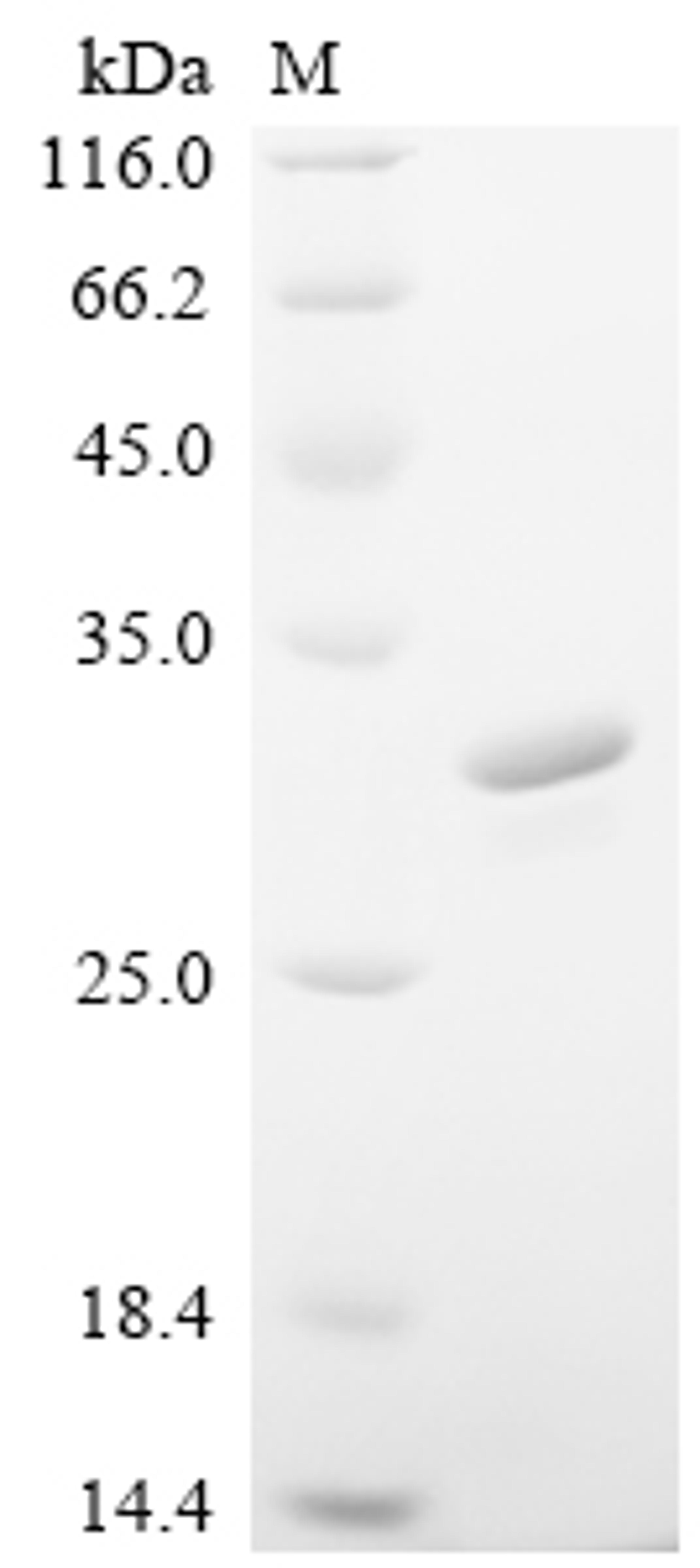 (Tris-Glycine gel) Discontinuous SDS-PAGE (reduced) with 5% enrichment gel and 15% separation gel.