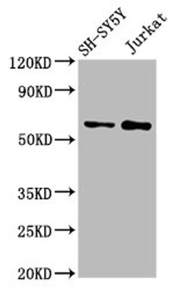 Western Blot. Positive WB detected in: SH-SY5Y whole cell lysate, Jurkat whole cell lysate. All lanes: MGAT4B antibody at 3µg/ml. Secondary. Goat polyclonal to rabbit IgG at 1/50000 dilution. Predicted band size: 64, 65 kDa. Observed band size: 64 kDa