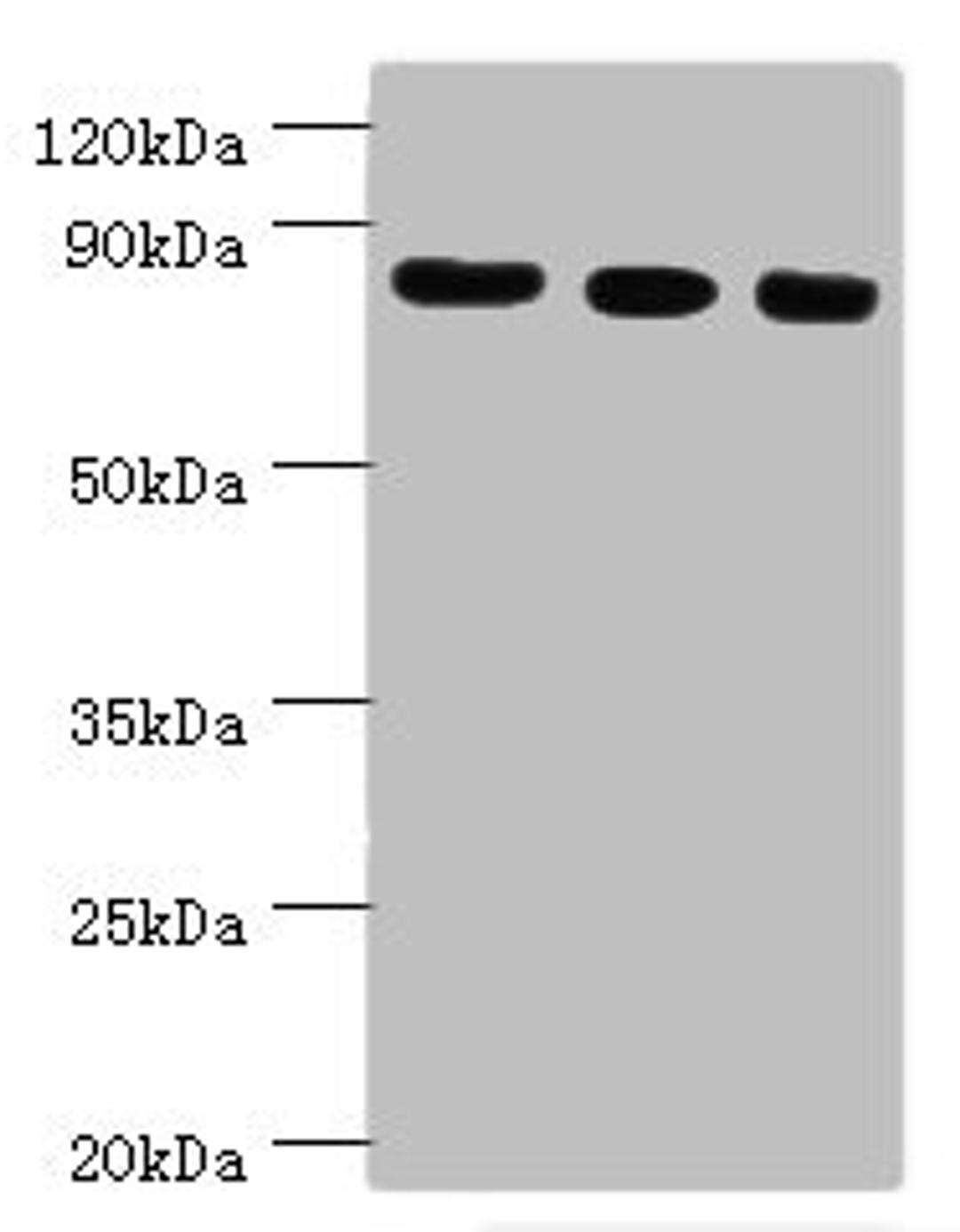 Western blot. All lanes: Histone-lysine N-methyltransferase EZH2 antibody at 12ug/ml. Lane 1: A431 whole cell lysate. Lane 2: Jurkat whole cell lysate. Lane 3: Mouse kidney tissue. Secondary. Goat polyclonal to rabbit IgG at 1/10000 dilution. Predicted band size: 86, 87, 82, 85, 80 kDa. Observed band size: 86 kDa. 