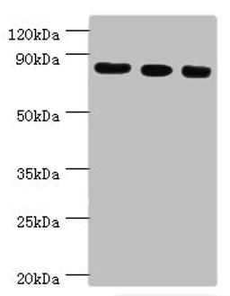 Western blot. All lanes: Histone-lysine N-methyltransferase EZH2 antibody at 12ug/ml. Lane 1: A431 whole cell lysate. Lane 2: Jurkat whole cell lysate. Lane 3: Mouse kidney tissue. Secondary. Goat polyclonal to rabbit IgG at 1/10000 dilution. Predicted band size: 86, 87, 82, 85, 80 kDa. Observed band size: 86 kDa. 