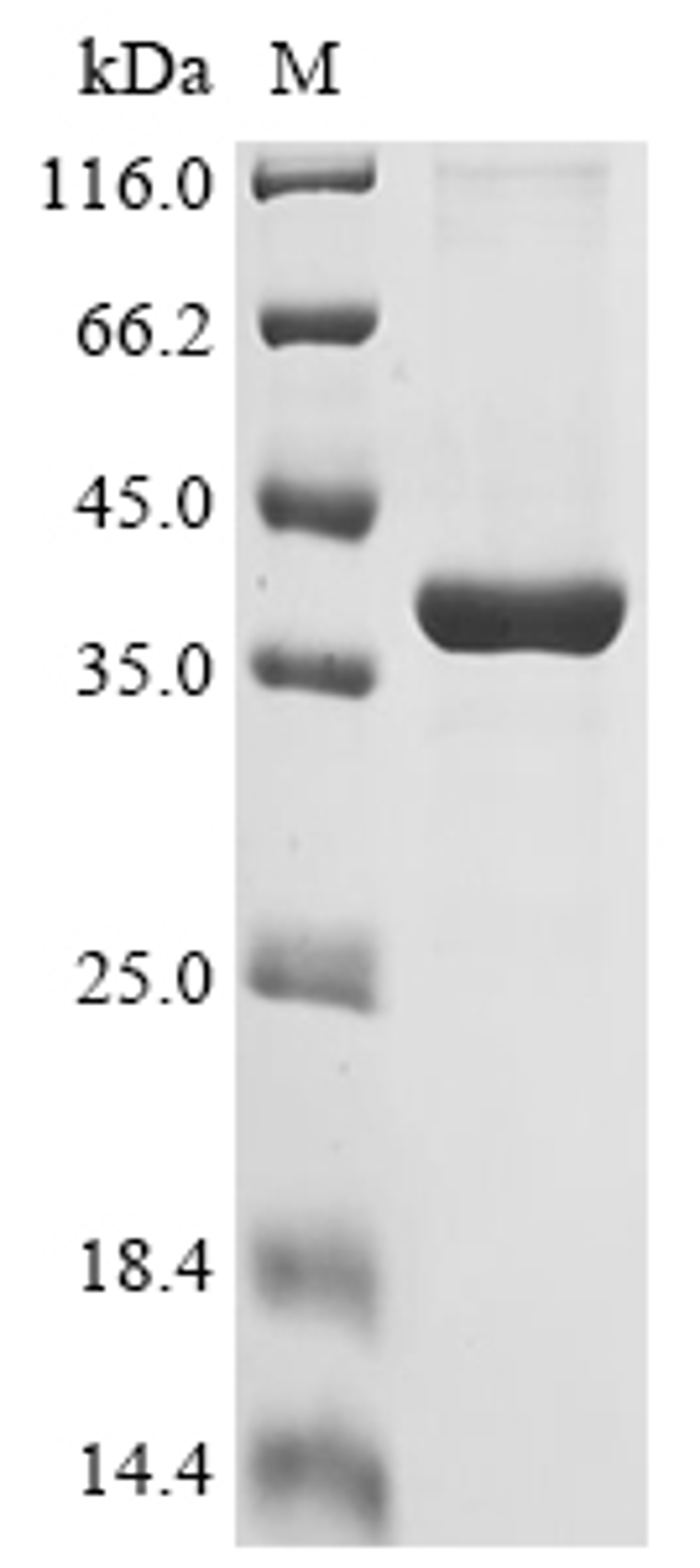 (Tris-Glycine gel) Discontinuous SDS-PAGE (reduced) with 5% enrichment gel and 15% separation gel.