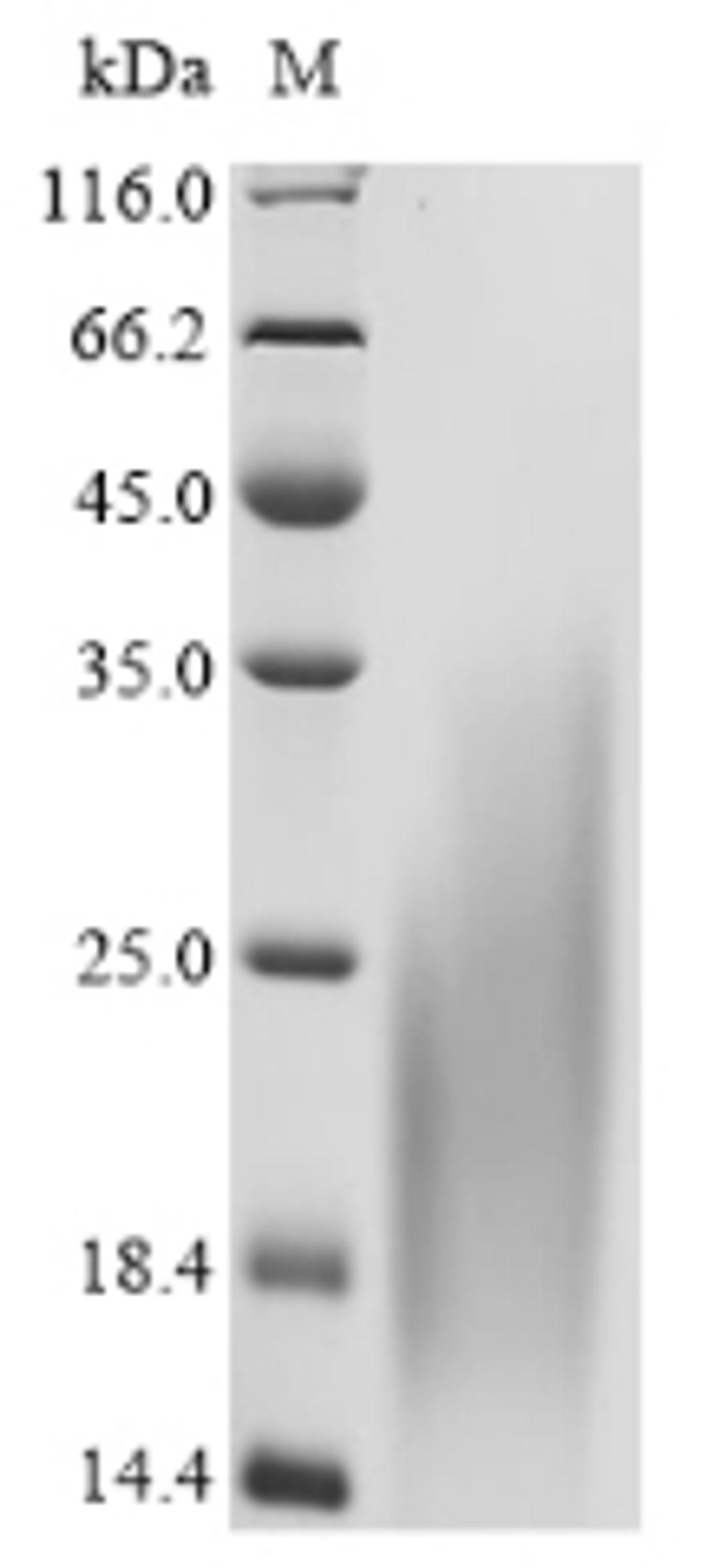 (Tris-Glycine gel) Discontinuous SDS-PAGE (reduced) with 5% enrichment gel and 15% separation gel.