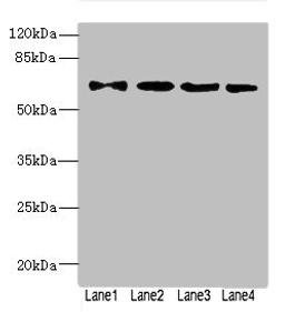 Western blot. All lanes: ZNF324antibody at 1.57ug/ml. Lane 1: A549 whole cell lysate. Lane 2: 293T whole cell lysate. Lane 3: MCF-7 whole cell lysate. Lane 4: Jurkat whole cell lysate. Secondary. Goat polyclonal to rabbit IgG at 1/10000 dilution. Predicted band size: 61 kDa. Observed band size: 61 kDa. 