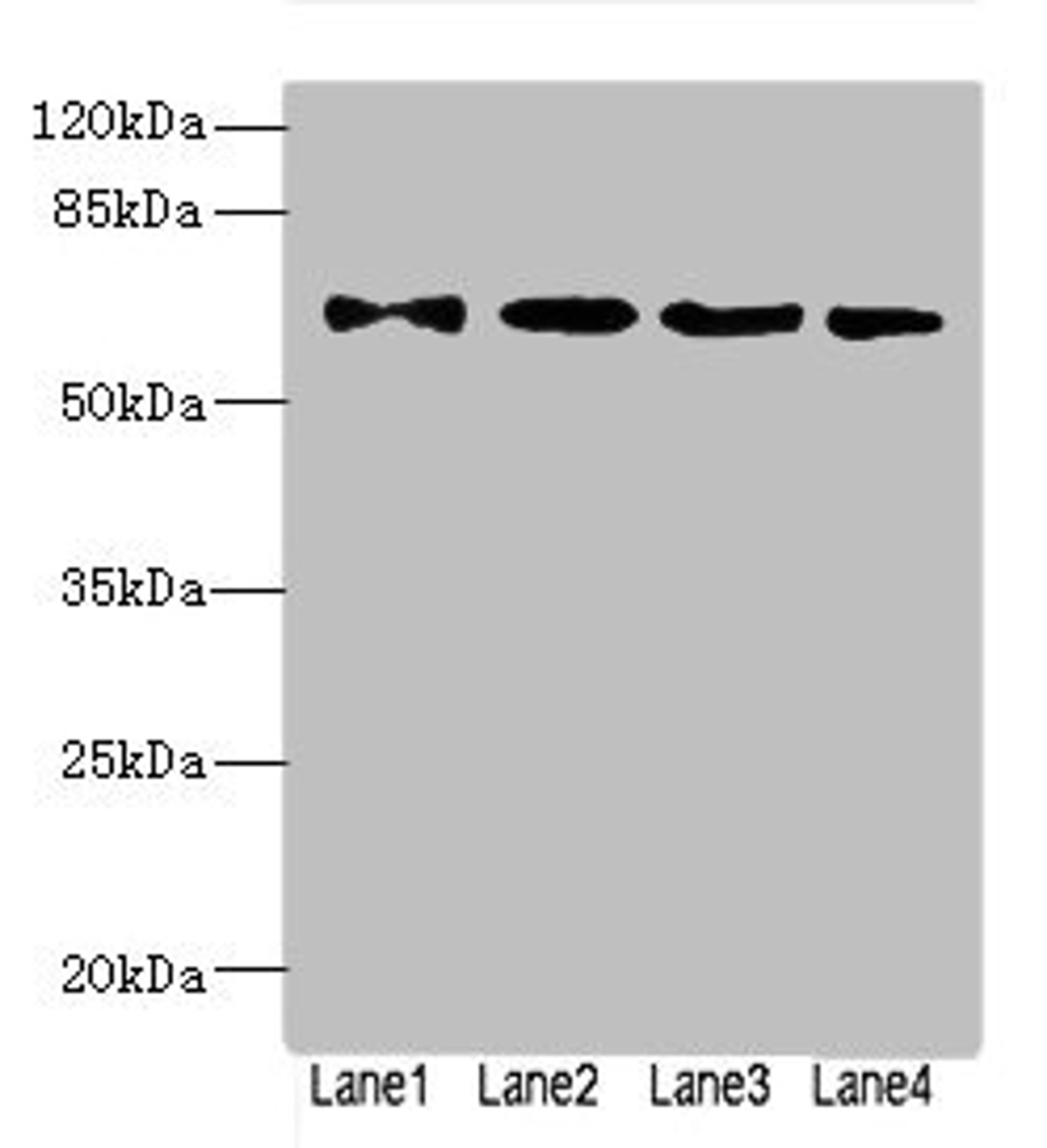 Western blot. All lanes: ZNF324antibody at 1.57ug/ml. Lane 1: A549 whole cell lysate. Lane 2: 293T whole cell lysate. Lane 3: MCF-7 whole cell lysate. Lane 4: Jurkat whole cell lysate. Secondary. Goat polyclonal to rabbit IgG at 1/10000 dilution. Predicted band size: 61 kDa. Observed band size: 61 kDa. 