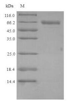 (Tris-Glycine gel) Discontinuous SDS-PAGE (reduced) with 5% enrichment gel and 15% separation gel.