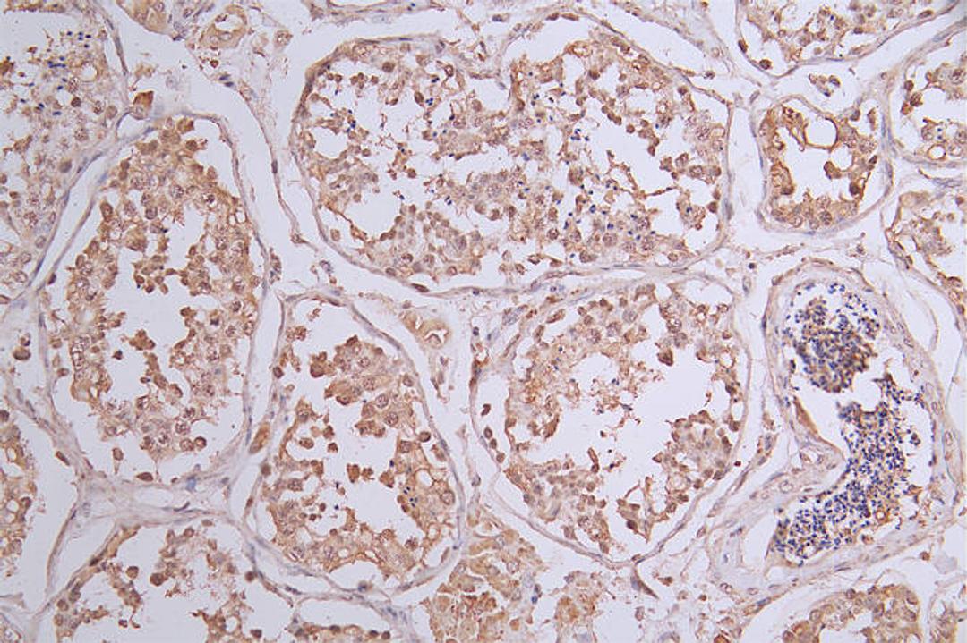 IHC image of CSB-RA588766A0HU diluted at 1:50 and staining in paraffin-embedded human testis tissue performed on a Leica BondTM system. After dewaxing and hydration, antigen retrieval was mediated by high pressure in a citrate buffer (pH 6.0). Section was blocked with 10% normal goat serum 30min at RT. Then primary antibody (1% BSA) was incubated at 4°C overnight. The primary is detected by a Goat anti-rabbit polymer IgG labeled by HRP and visualized using 0.23% DAB.