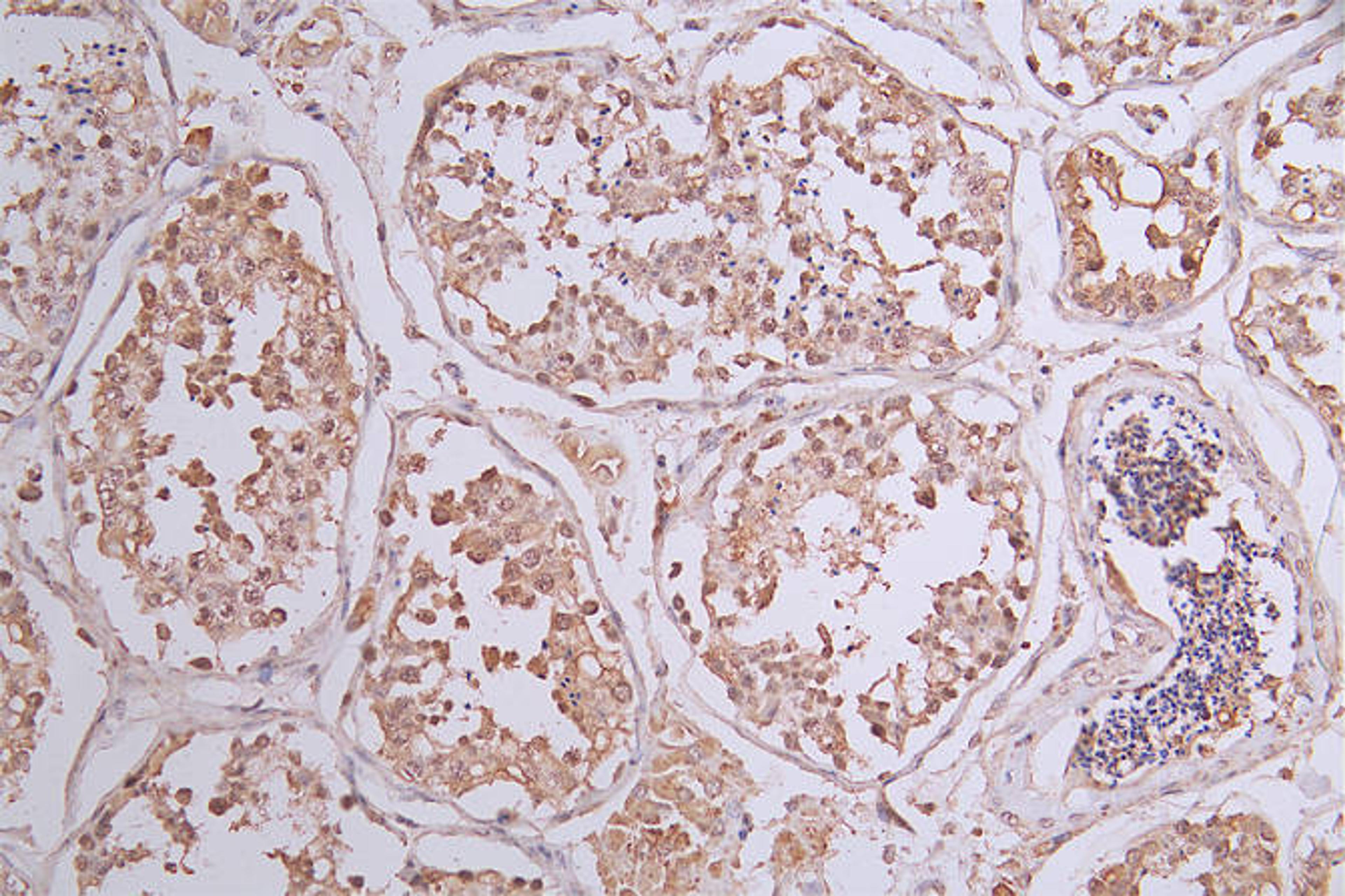 IHC image of CSB-RA588766A0HU diluted at 1:50 and staining in paraffin-embedded human testis tissue performed on a Leica BondTM system. After dewaxing and hydration, antigen retrieval was mediated by high pressure in a citrate buffer (pH 6.0). Section was blocked with 10% normal goat serum 30min at RT. Then primary antibody (1% BSA) was incubated at 4°C overnight. The primary is detected by a Goat anti-rabbit polymer IgG labeled by HRP and visualized using 0.23% DAB.