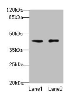 Western blot. All lanes: VPS45 antibody at 3ug/ml. Lane 1: Mouse brain tissue. Lane 2: U87 whole cell lysate. Secondary. Goat polyclonal to rabbit IgG at 1/10000 dilution. Predicted band size: 66, 62 kDa. Observed band size: 41 kDa. 
