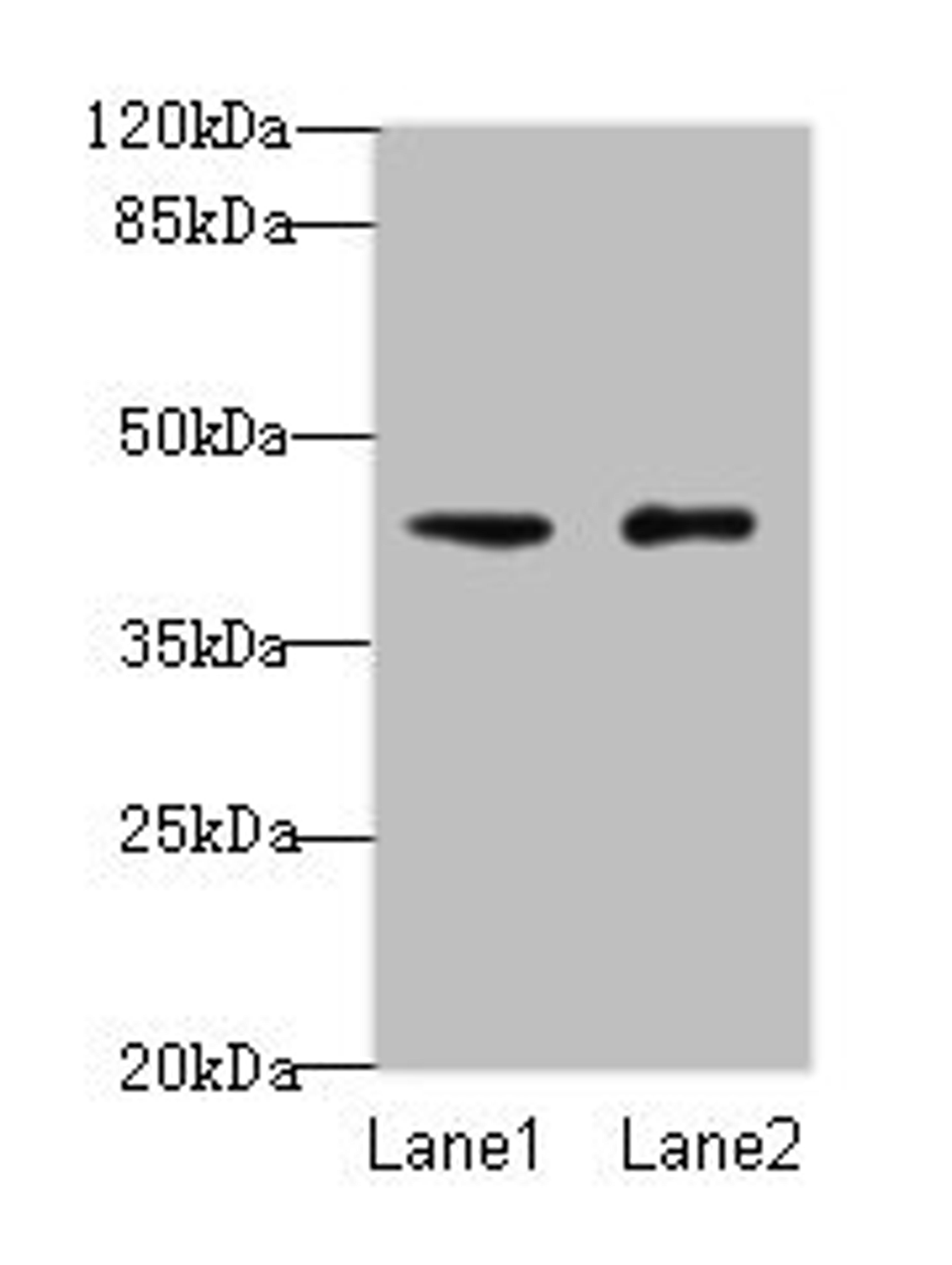 Western blot. All lanes: VPS45 antibody at 3ug/ml. Lane 1: Mouse brain tissue. Lane 2: U87 whole cell lysate. Secondary. Goat polyclonal to rabbit IgG at 1/10000 dilution. Predicted band size: 66, 62 kDa. Observed band size: 41 kDa. 
