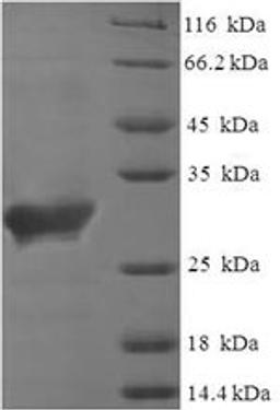 (Tris-Glycine gel) Discontinuous SDS-PAGE (reduced) with 5% enrichment gel and 15% separation gel.