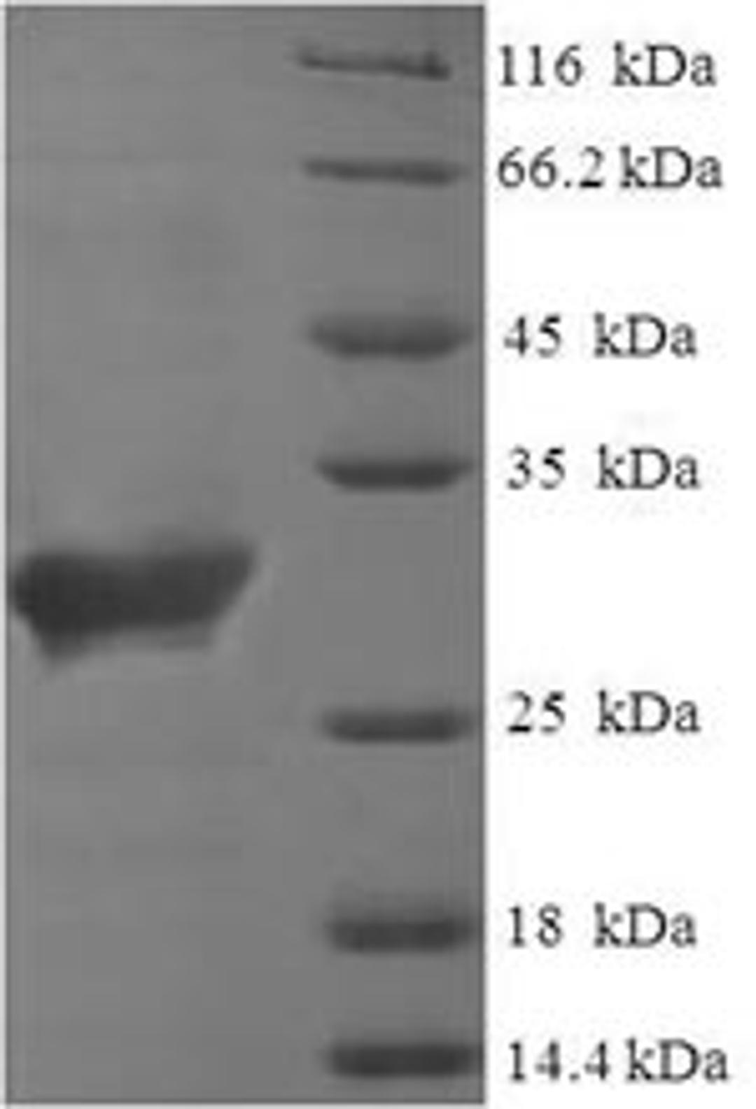 (Tris-Glycine gel) Discontinuous SDS-PAGE (reduced) with 5% enrichment gel and 15% separation gel.