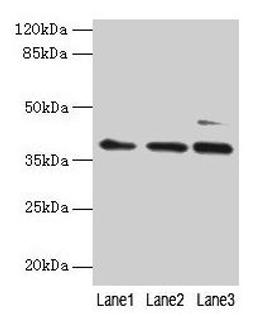 Western blot. All lanes: MRPL3 antibody at 6µg/ml. Lane 1: Hela whole cell lysate. Lane 2: HepG2 whole cell lysate. Lane 3: A549 whole cell lysate. Secondary. Goat polyclonal to rabbit IgG at 1/10000 dilution. Predicted band size: 39 kDa. Observed band size: 39 kDa