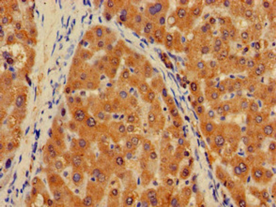 Immunohistochemistry of paraffin-embedded human liver tissue using CSB-PA659725LA01HU at dilution of 1:100