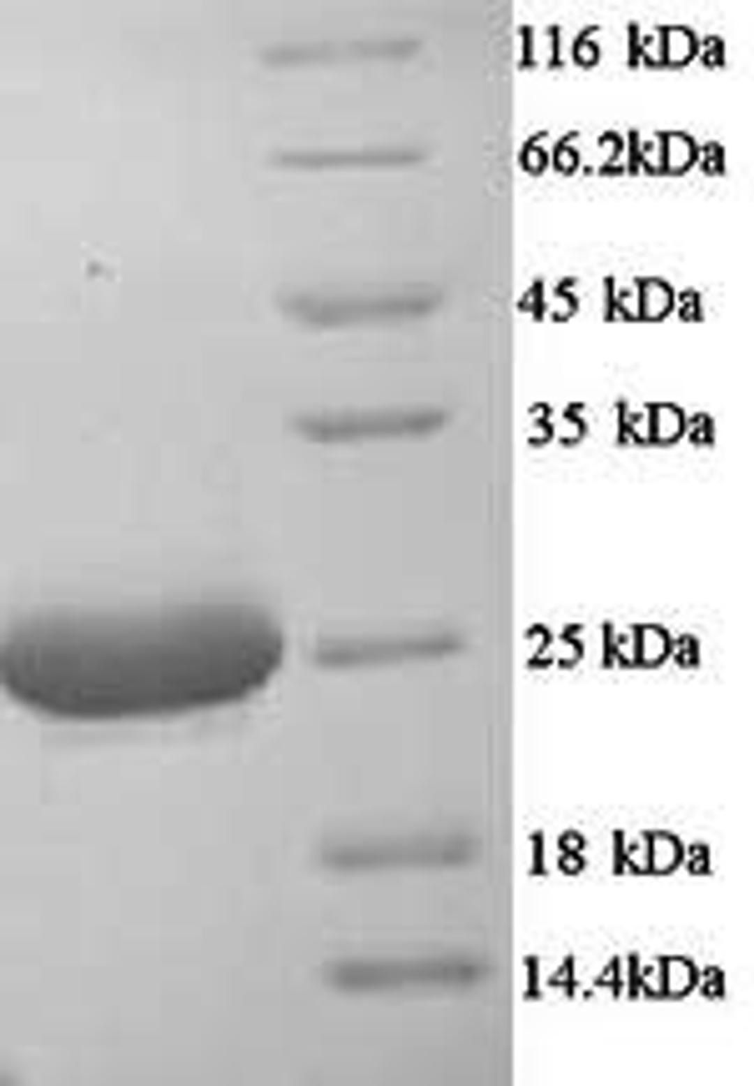 (Tris-Glycine gel) Discontinuous SDS-PAGE (reduced) with 5% enrichment gel and 15% separation gel.