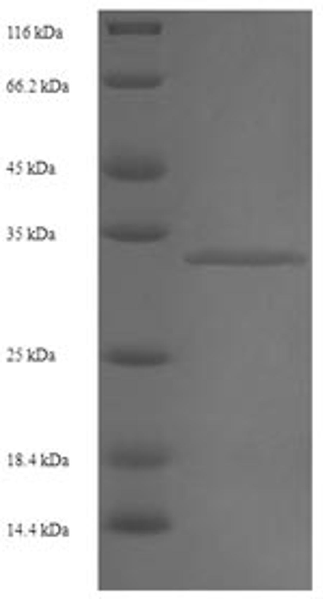 (Tris-Glycine gel) Discontinuous SDS-PAGE (reduced) with 5% enrichment gel and 15% separation gel.
