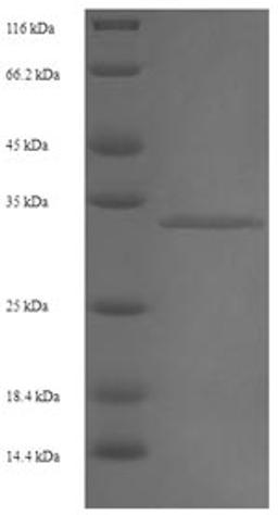 (Tris-Glycine gel) Discontinuous SDS-PAGE (reduced) with 5% enrichment gel and 15% separation gel.