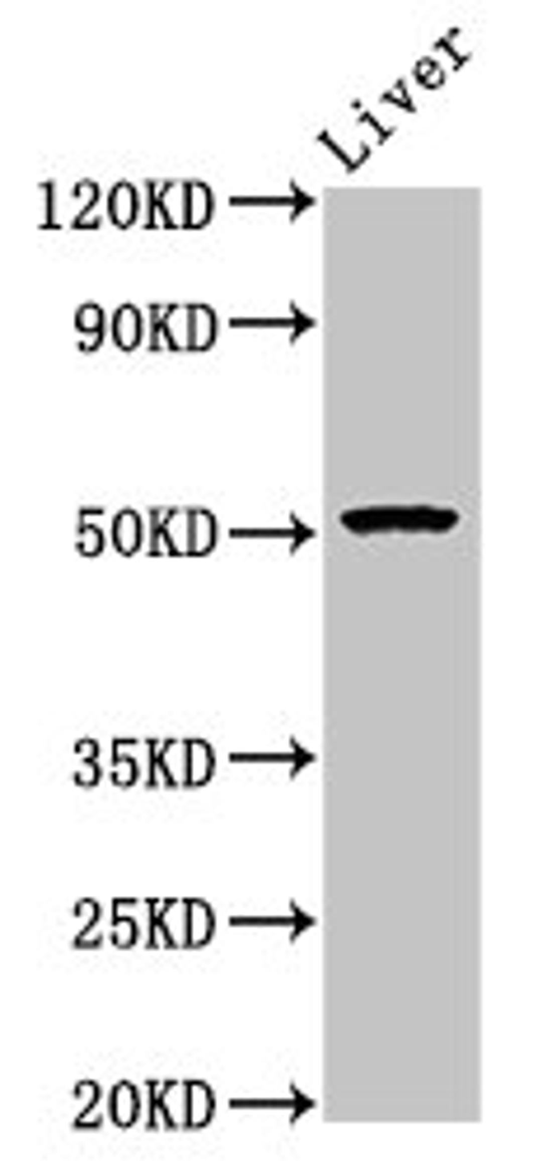 Western Blot. Positive WB detected in: Mouse liver tissue. All lanes: POLD3 antibody at 5.4ug/ml. Secondary. Goat polyclonal to rabbit IgG at 1/50000 dilution. Predicted band size: 52, 47, 40 kDa. Observed band size: 52 kDa. 