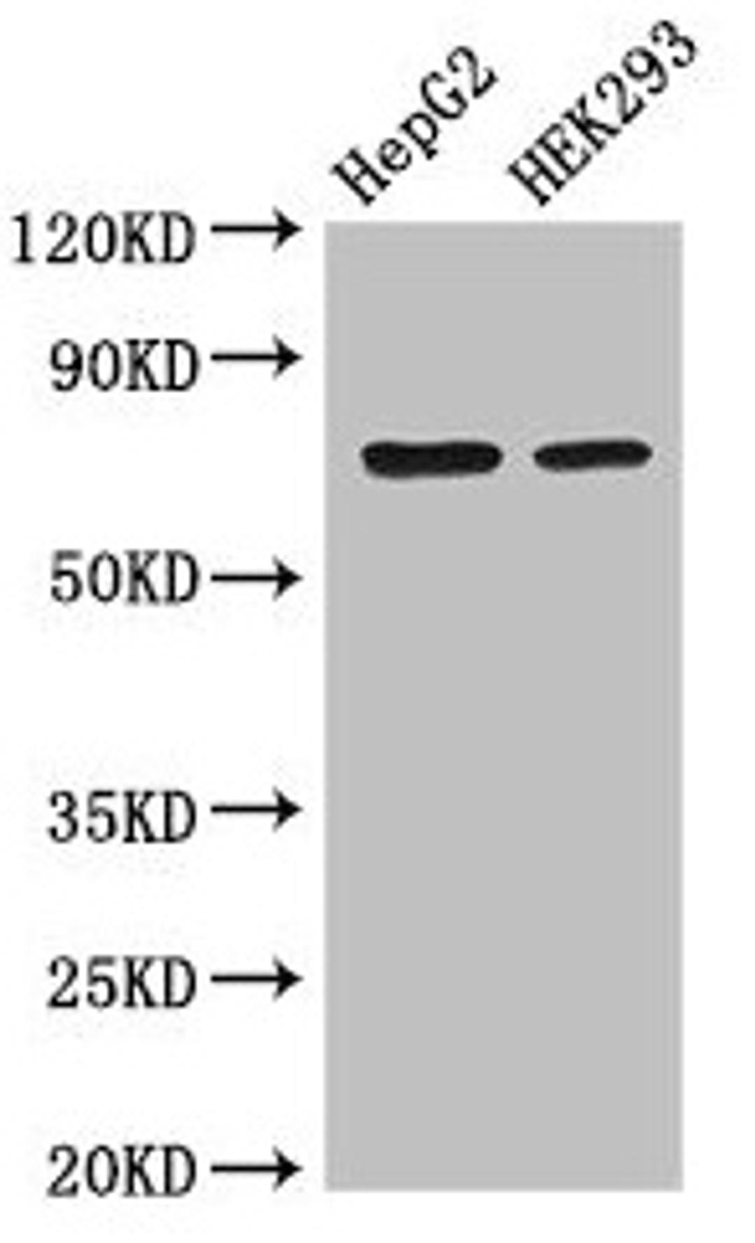 Western Blot. Positive WB detected in: HepG2 whole cell lysate, HEK293 whole cell lysate. All lanes: OS9 antibody at 3.4µg/ml. Secondary. Goat polyclonal to rabbit IgG at 1/50000 dilution. Predicted band size: 76, 70, 68, 74, 66, 64, 61 kDa. Observed band size: 70 kDa