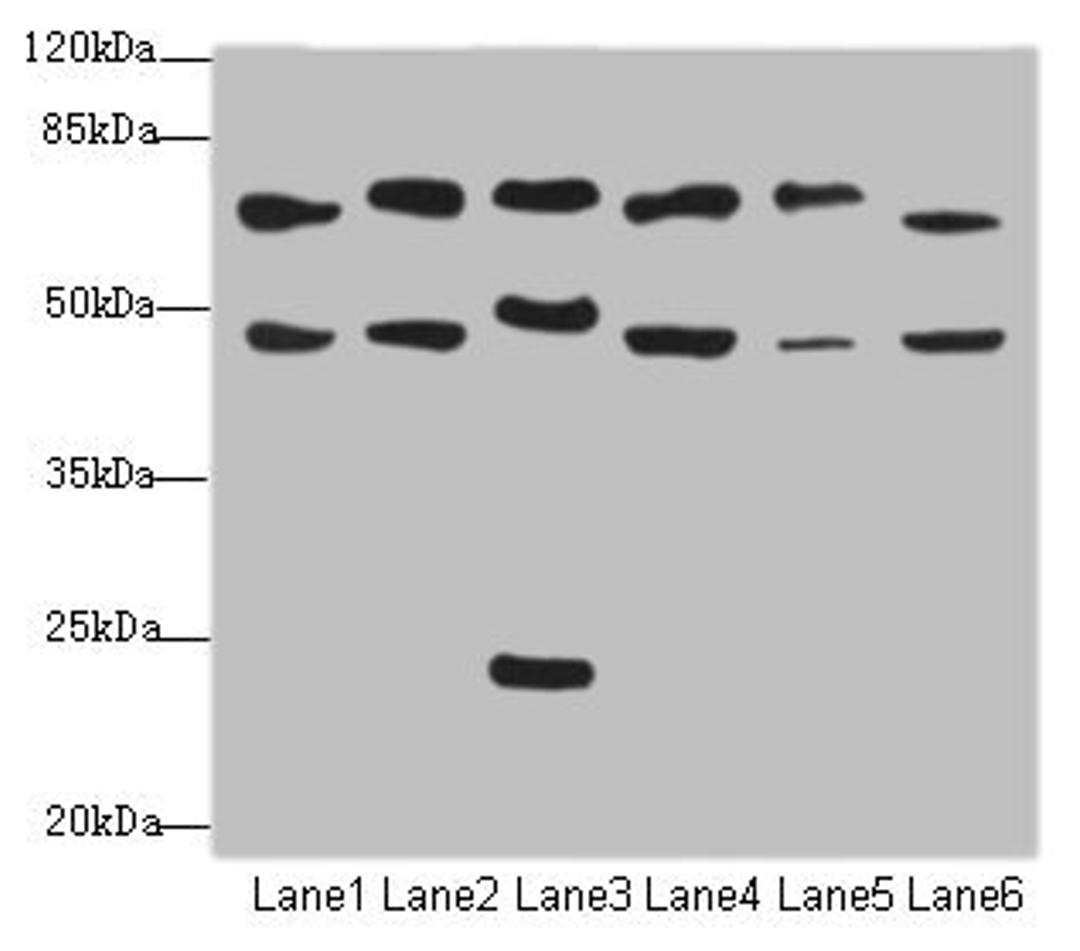 Western blot. All lanes: CSRNP2antibody at 2.34ug/ml. Lane 1: Mouse liver tissue. Lane 2: Mouse heart tissue. Lane 3: Mouse lung tissue. Lane 4: Mouse kidney tissue. Lane 5: HepG2 whole cell lysate. Lane 6: Mouse brain tissue. Secondary. Goat polyclonal to rabbit IgG at 1/10000 dilution. Predicted band size: 60 kDa. Observed band size: 60, 48, 24 kDa. 