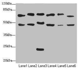 Western blot. All lanes: CSRNP2antibody at 2.34ug/ml. Lane 1: Mouse liver tissue. Lane 2: Mouse heart tissue. Lane 3: Mouse lung tissue. Lane 4: Mouse kidney tissue. Lane 5: HepG2 whole cell lysate. Lane 6: Mouse brain tissue. Secondary. Goat polyclonal to rabbit IgG at 1/10000 dilution. Predicted band size: 60 kDa. Observed band size: 60, 48, 24 kDa. 